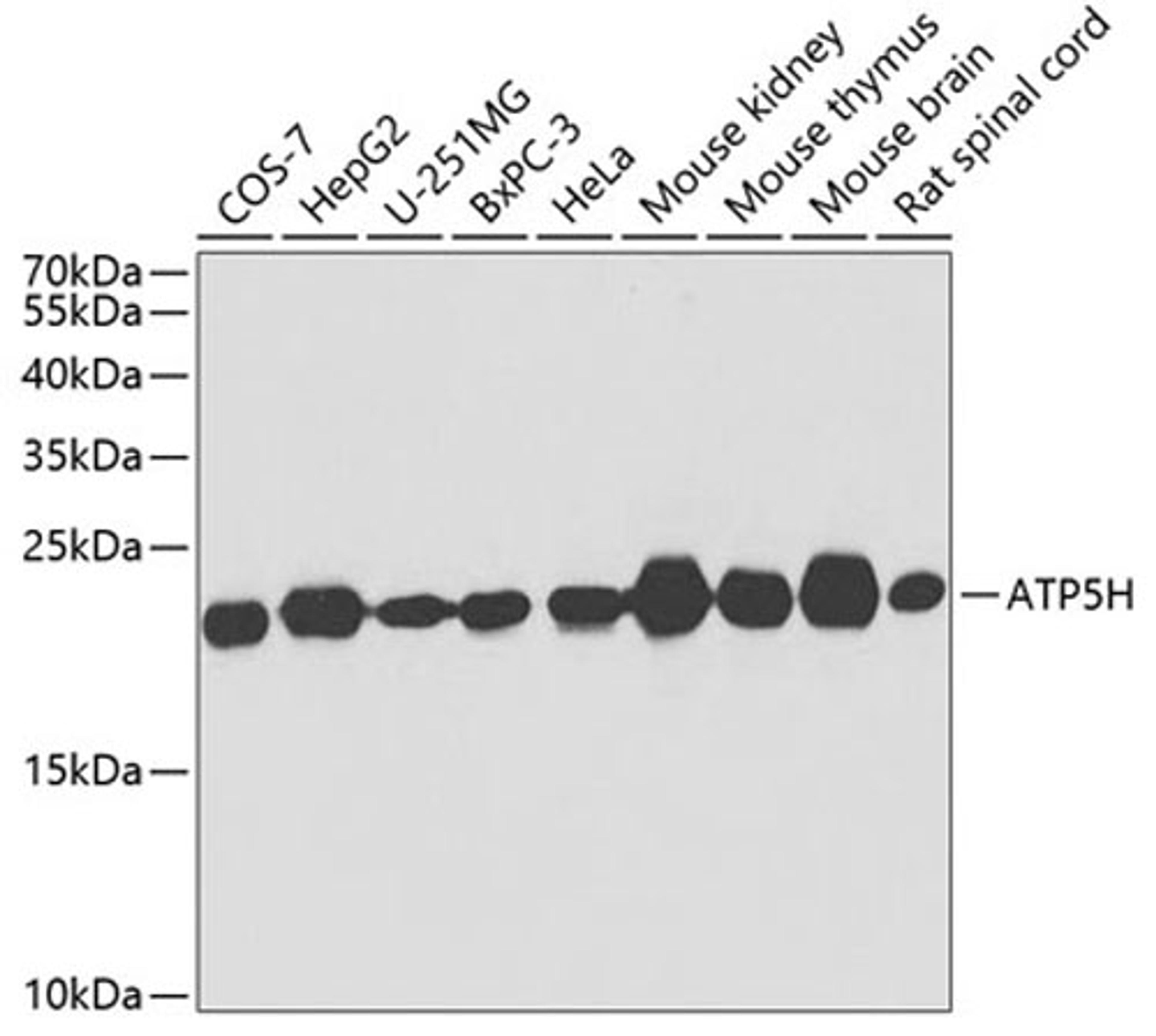 Western blot - ATP5H antibody (A4425)