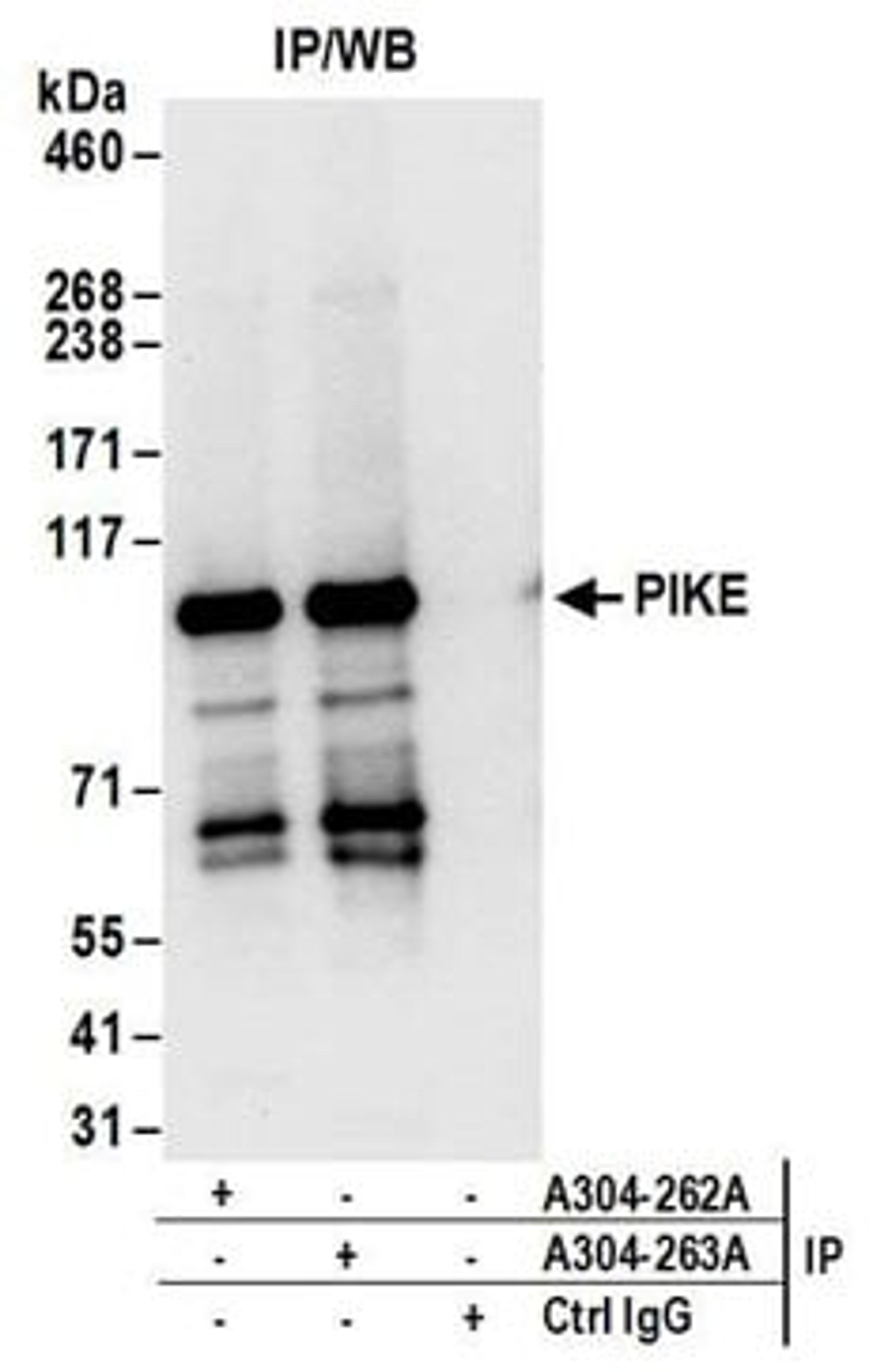 Detection of human PIKE by western blot of immunoprecipitates.