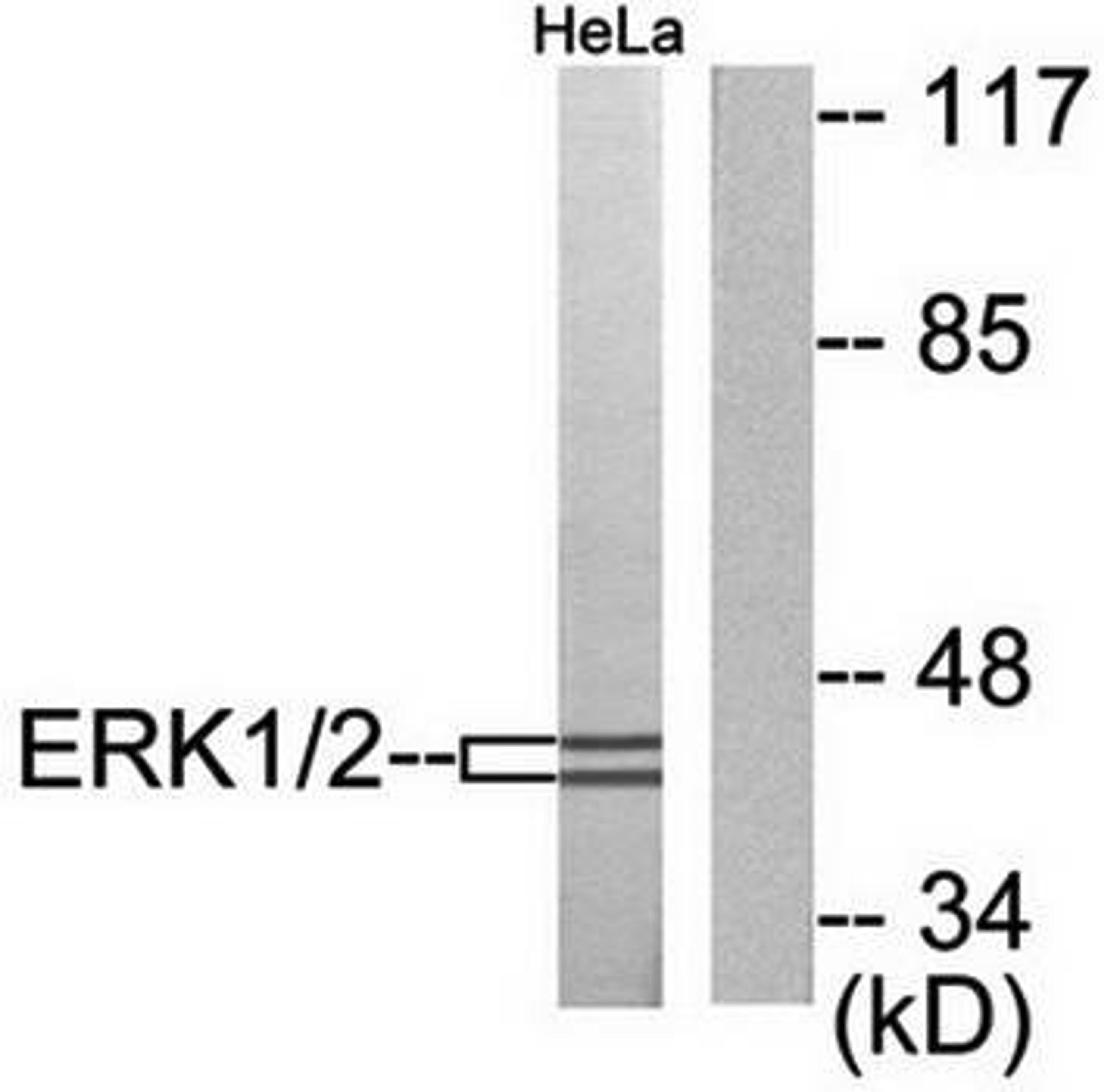 Western blot analysis of extracts from HeLa cells using p44-42 MAPK antibody