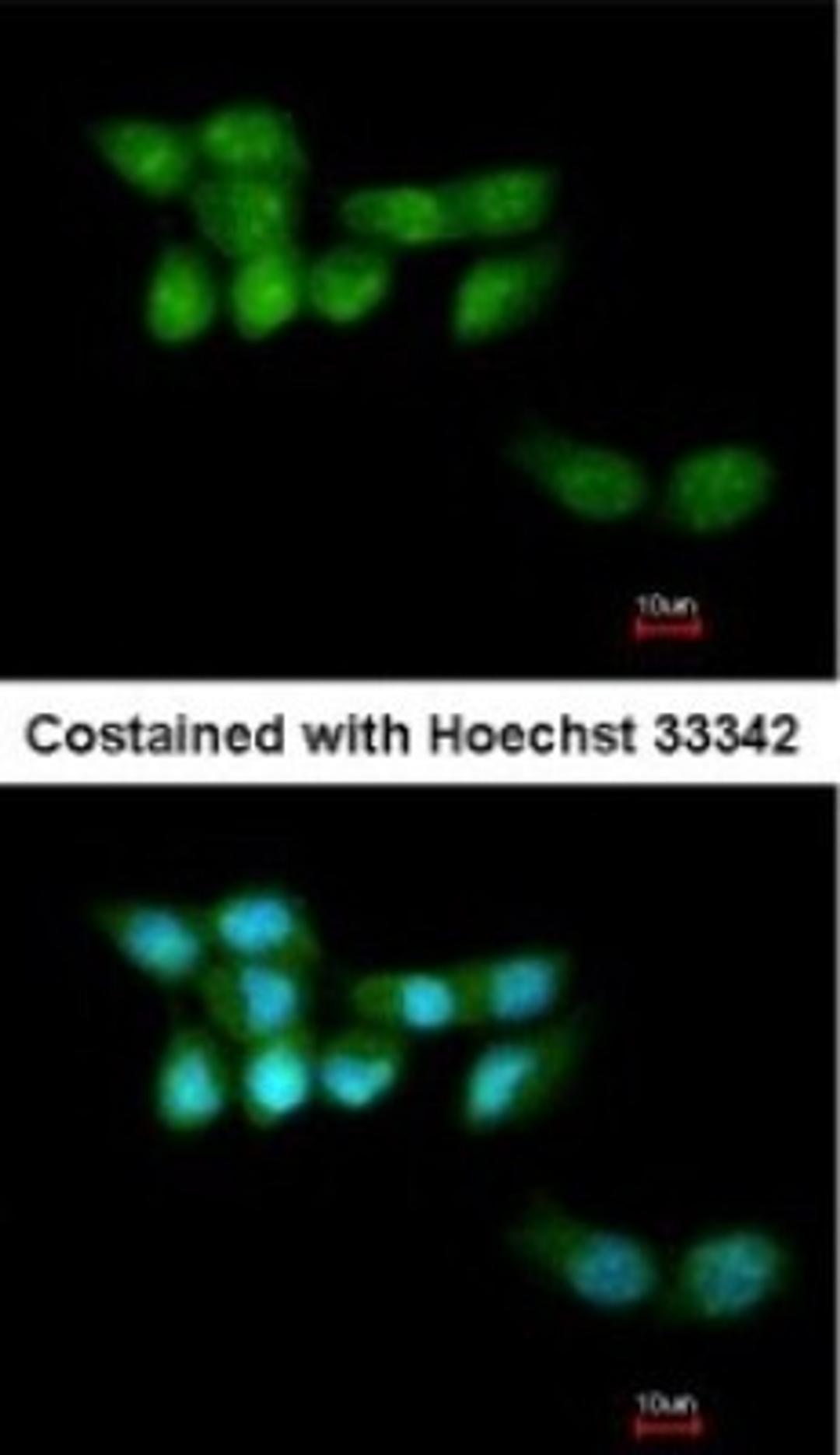 Immunocytochemistry/Immunofluorescence: UVSSA Antibody [NBP1-32598] - Paraformaldehyde-fixed A431, using antibody at 1:200 dilution.