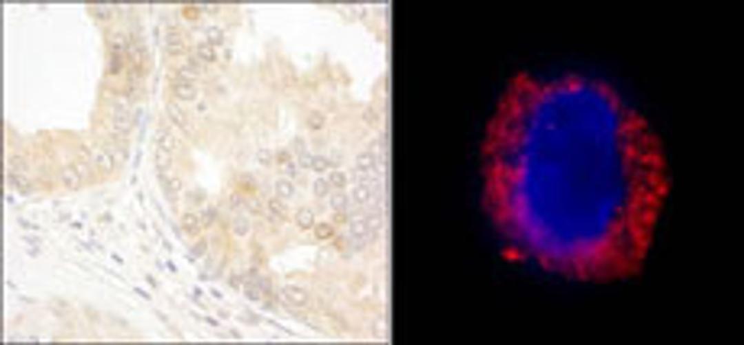 Detection of human cAbl by immunohistochemistry and immunocytochemistry.