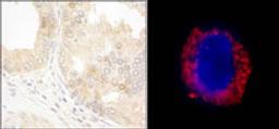 Detection of human cAbl by immunohistochemistry and immunocytochemistry.