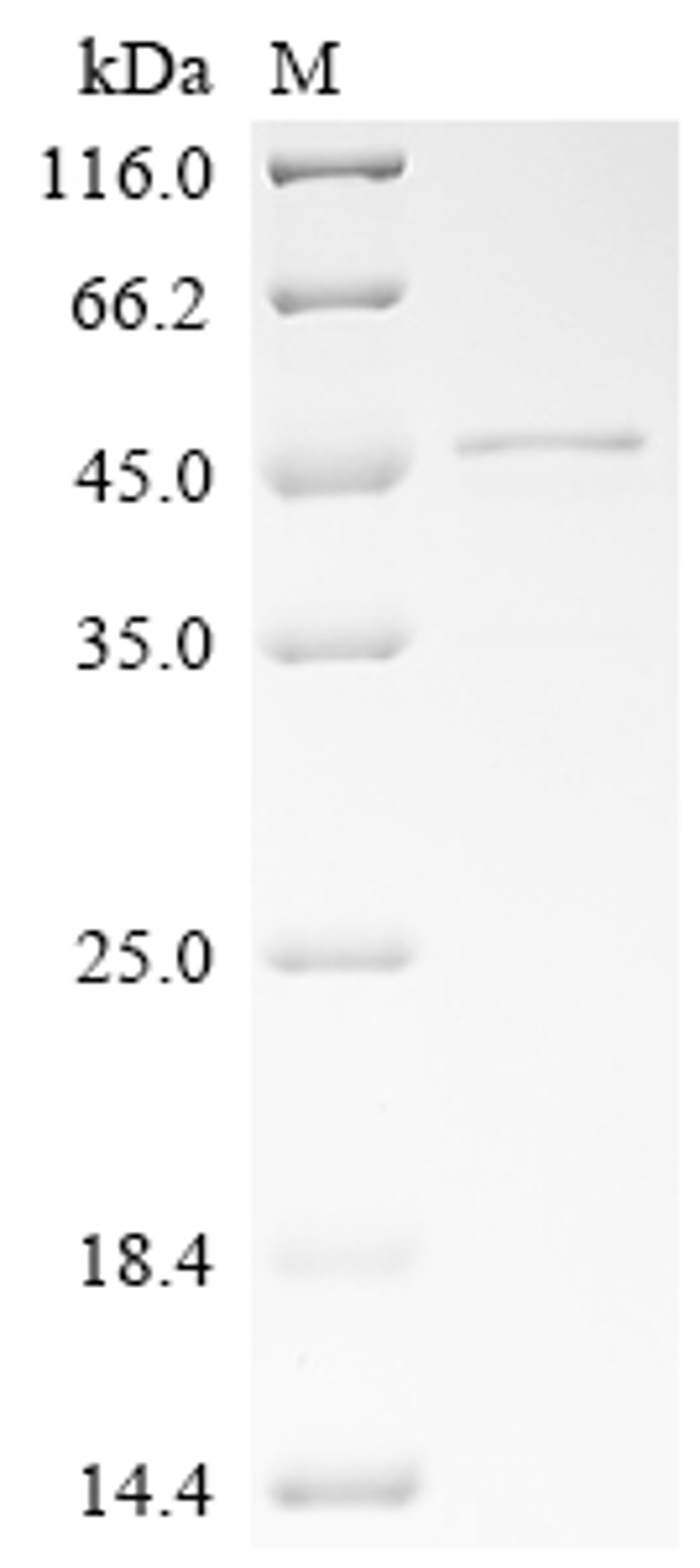 (Tris-Glycine gel) Discontinuous SDS-PAGE (reduced) with 5% enrichment gel and 15% separation gel.