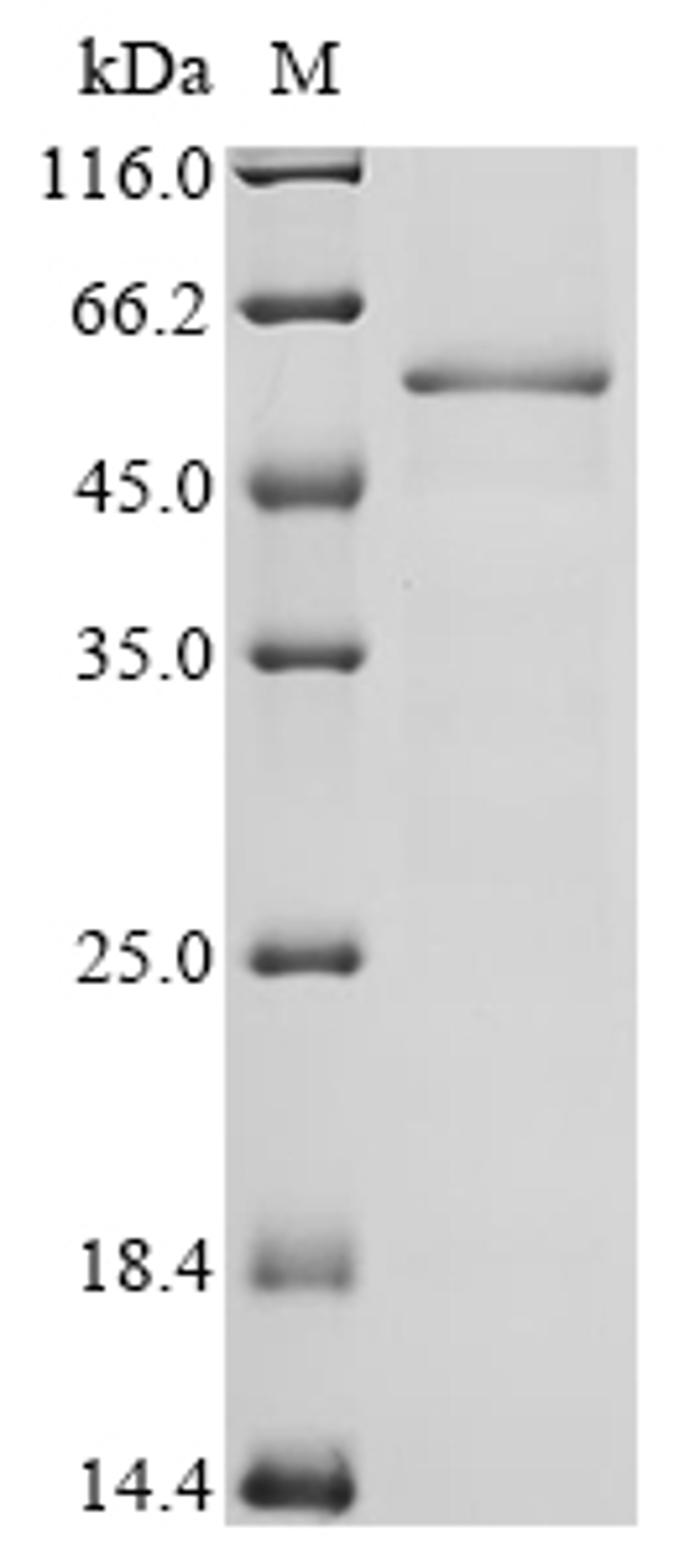 (Tris-Glycine gel) Discontinuous SDS-PAGE (reduced) with 5% enrichment gel and 15% separation gel.
