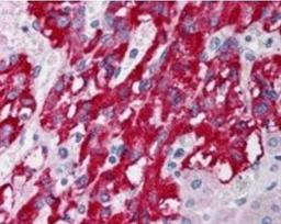 Immunohistochemical staining of Human Adrenal Gland using DLC1 antibody