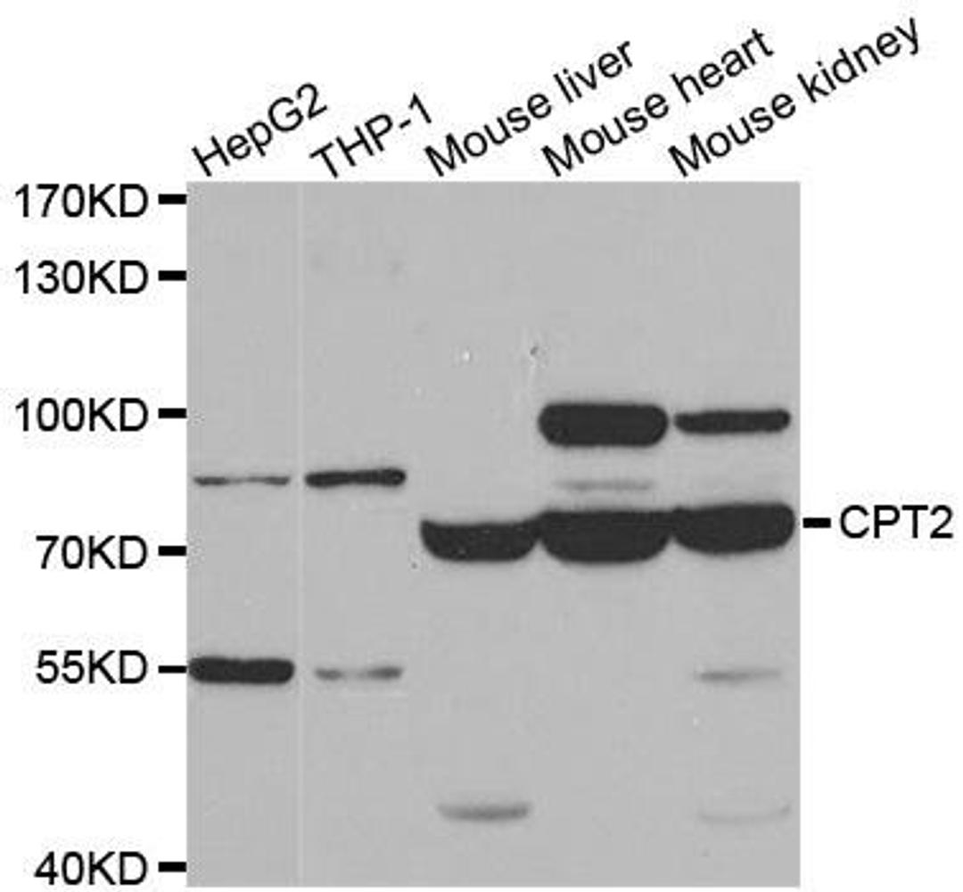 Western blot analysis of extracts of various cell lines using CPT2 antibody