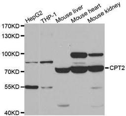 Western blot analysis of extracts of various cell lines using CPT2 antibody