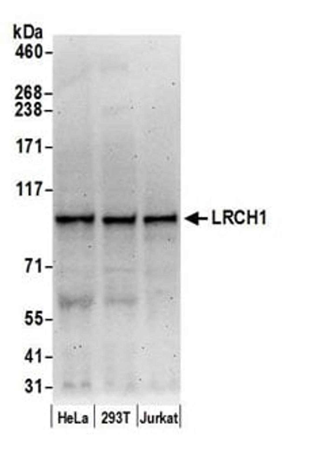 Detection of human LRCH1 by western blot.