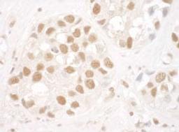 Detection of human Ku80 by immunohistochemistry.