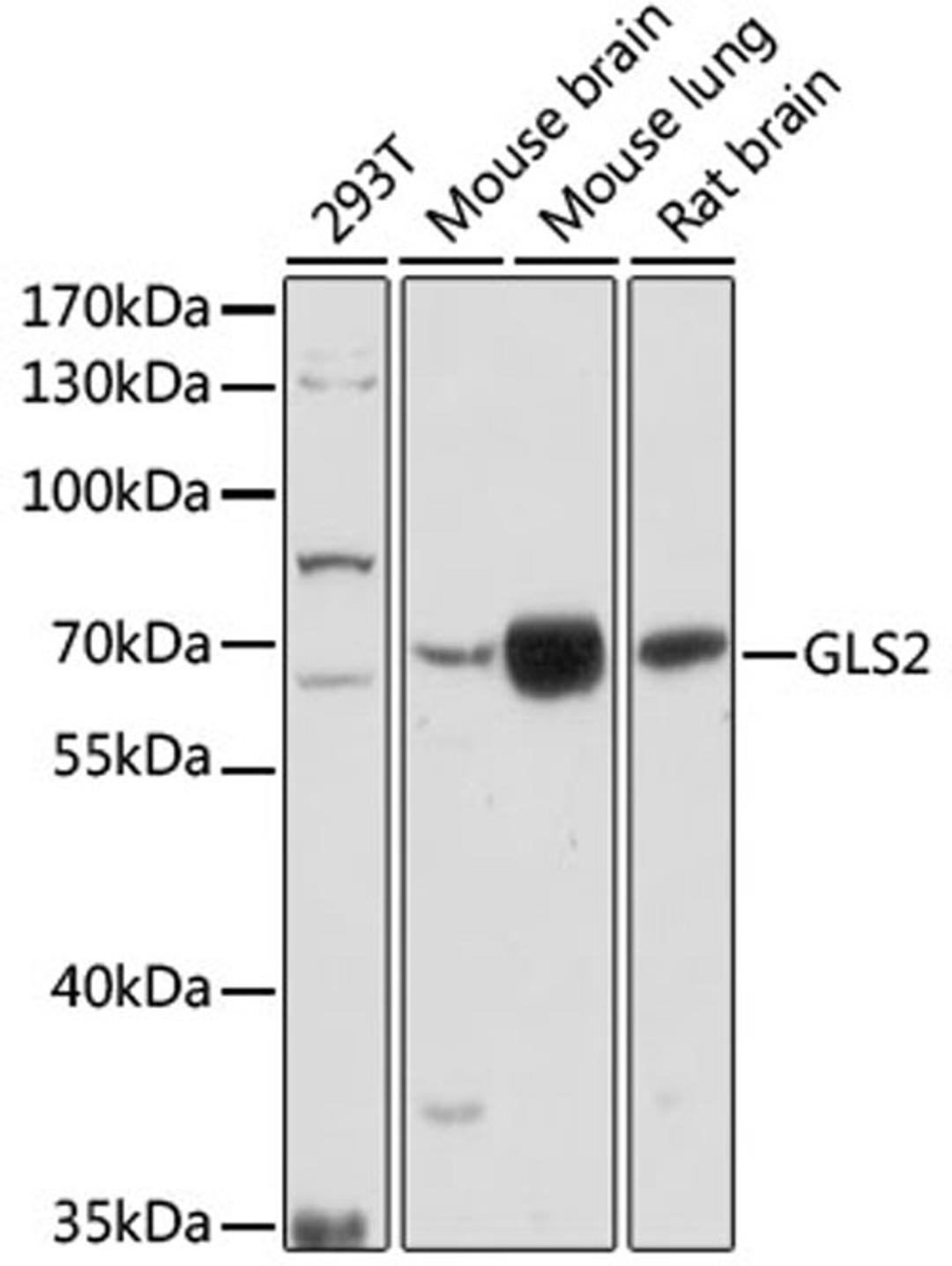 Western blot - GLS2 antibody (A16029)