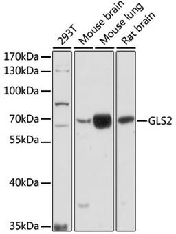 Western blot - GLS2 antibody (A16029)