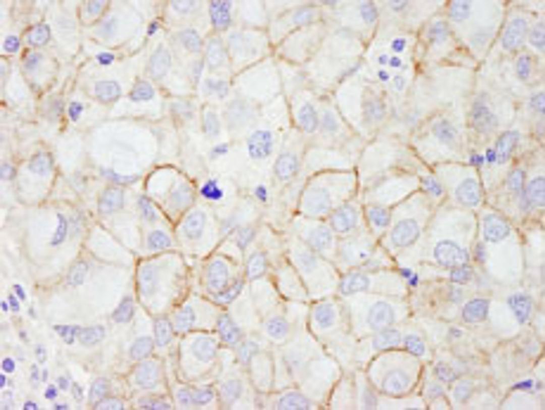 Detection of human ErbB2 by immunohistochemistry.