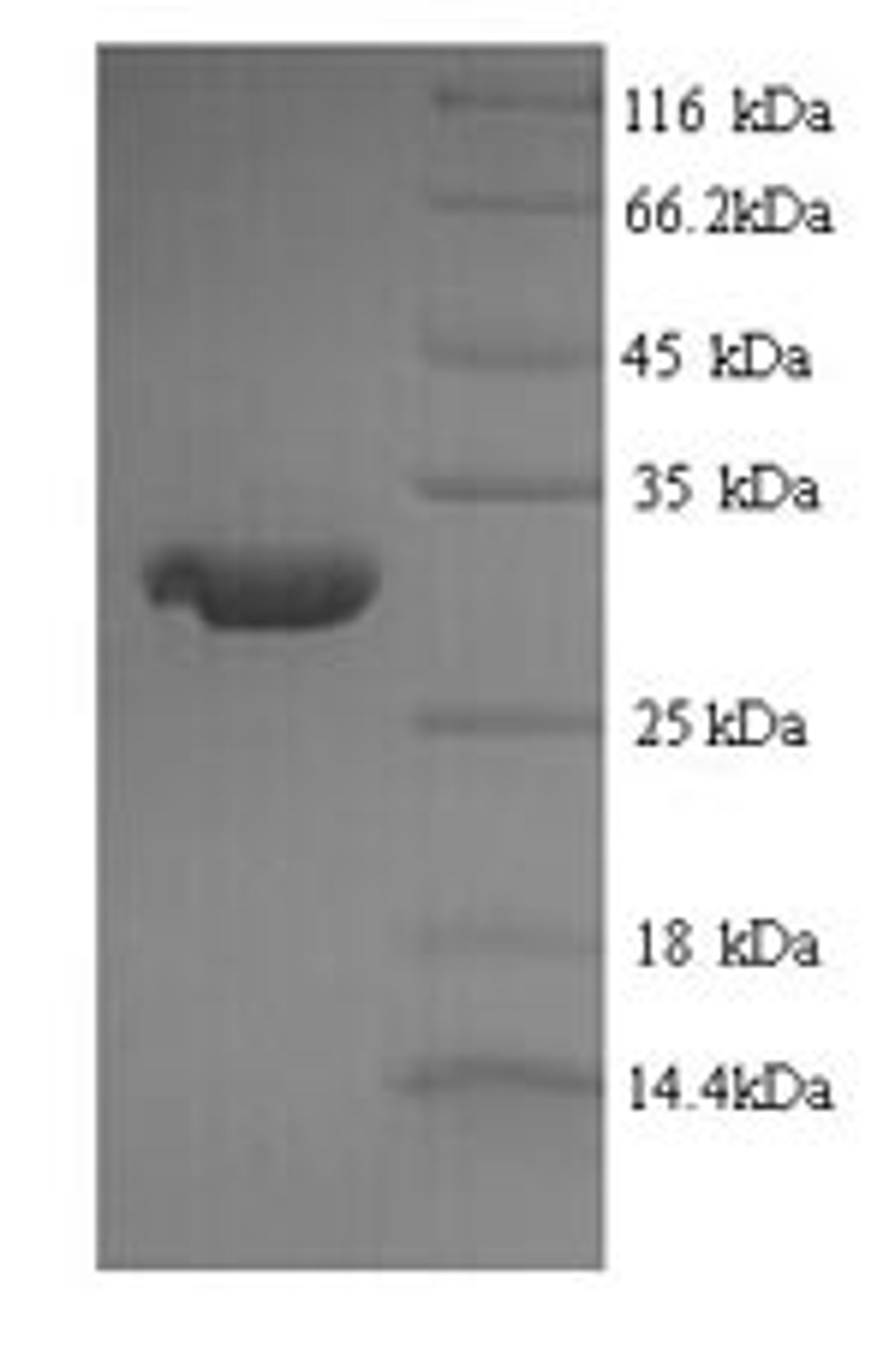 (Tris-Glycine gel) Discontinuous SDS-PAGE (reduced) with 5% enrichment gel and 15% separation gel.