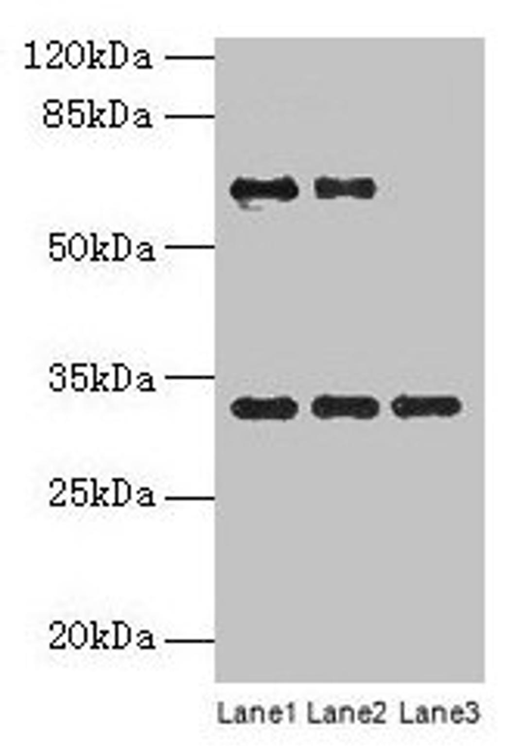 Western blot. All lanes: OTX2 antibody at 4µg/ml. Lane 1: Jurkat whole cell lysate. Lane 2: Hela whole cell lysate. Lane 3: Mouse lung tissue. Secondary. Goat polyclonal to rabbit IgG at 1/10000 dilution. Predicted band size: 32, 33 kDa. Observed band size: 32 kDa