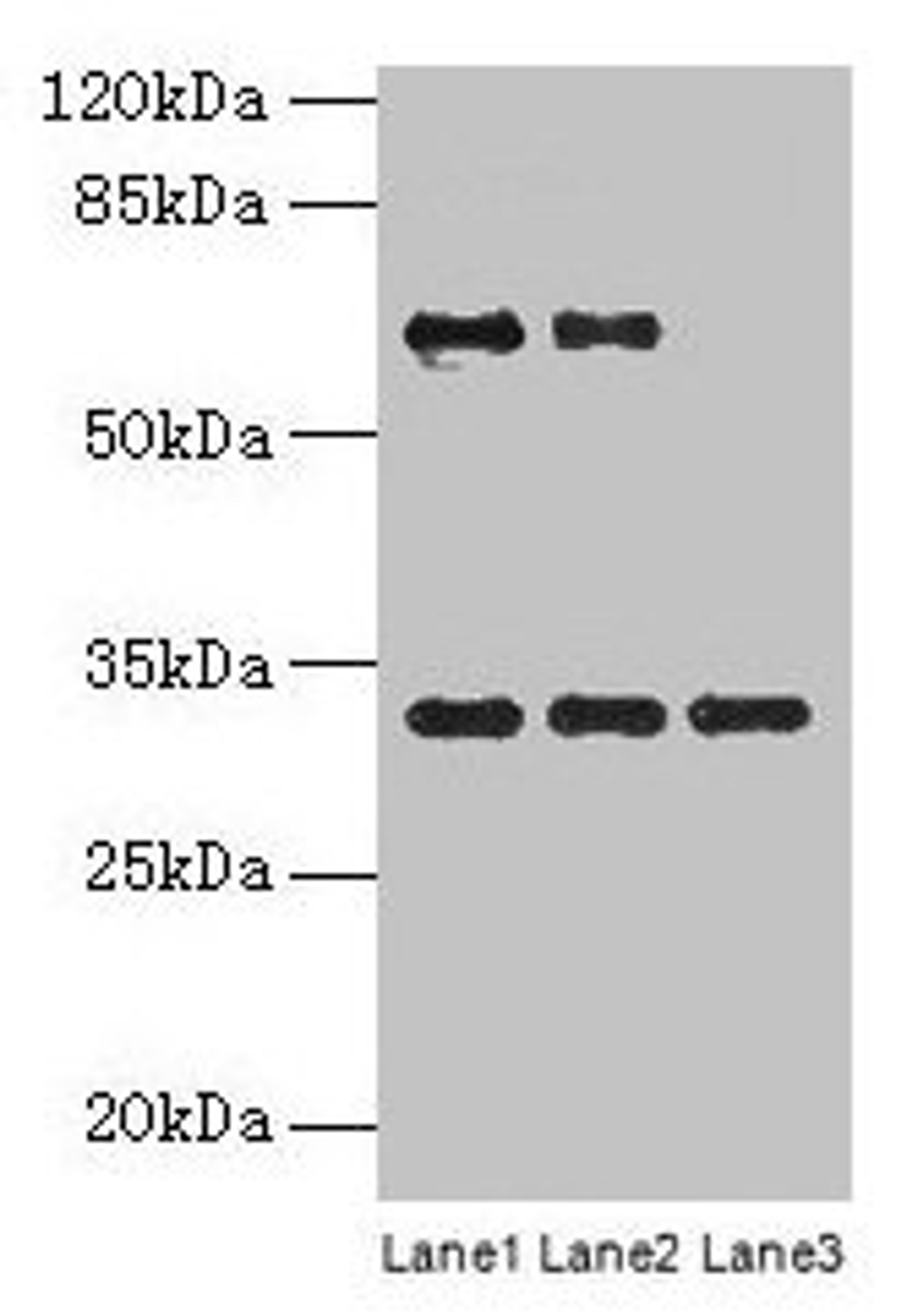 Western blot. All lanes: OTX2 antibody at 4µg/ml. Lane 1: Jurkat whole cell lysate. Lane 2: Hela whole cell lysate. Lane 3: Mouse lung tissue. Secondary. Goat polyclonal to rabbit IgG at 1/10000 dilution. Predicted band size: 32, 33 kDa. Observed band size: 32 kDa