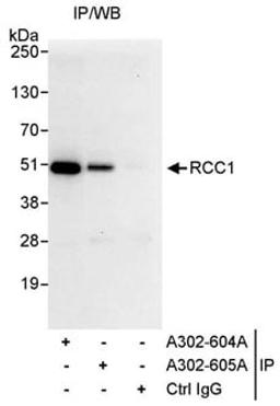 Detection of human RCC1 by western blot of immunoprecipitates.