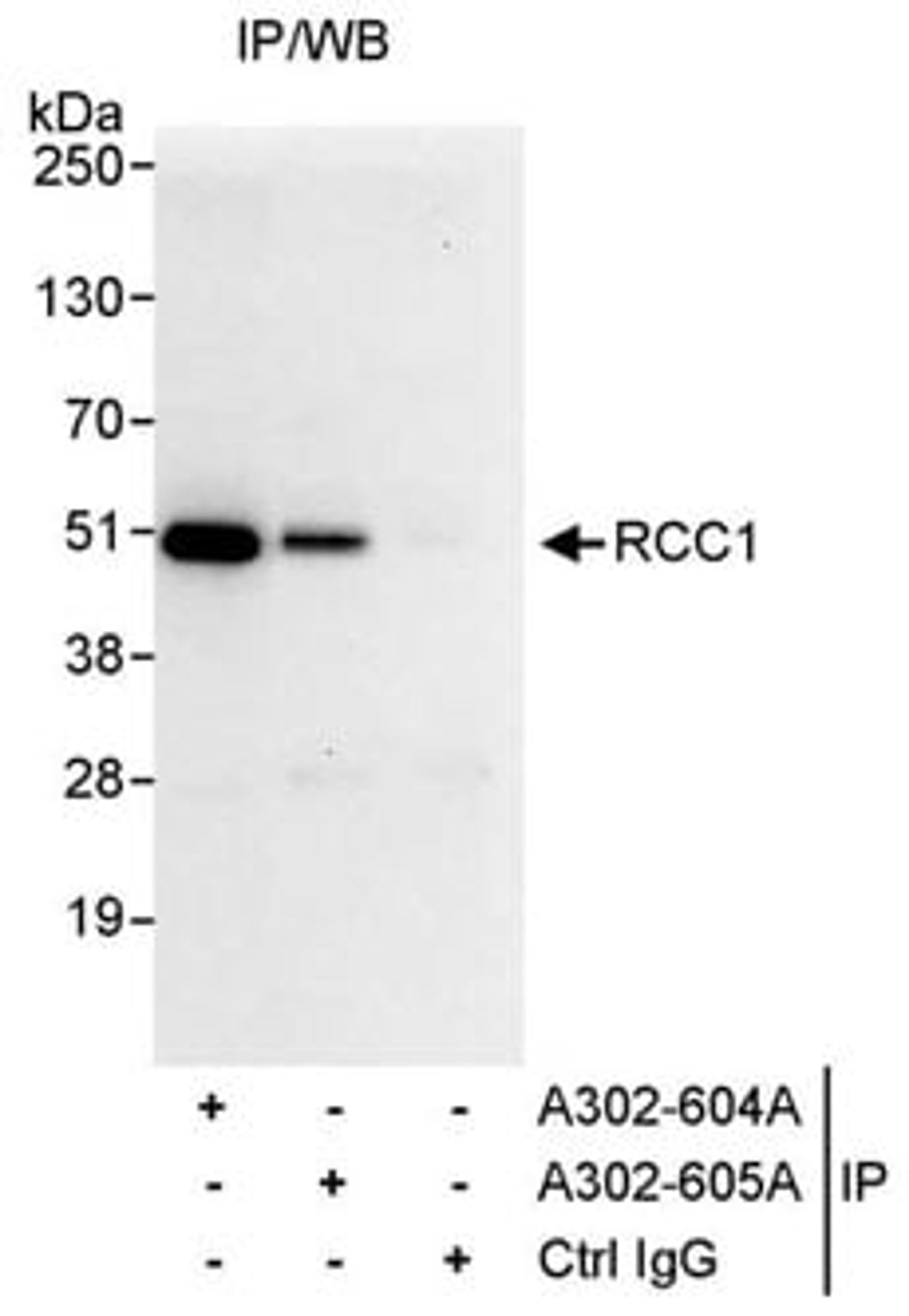 Detection of human RCC1 by western blot of immunoprecipitates.