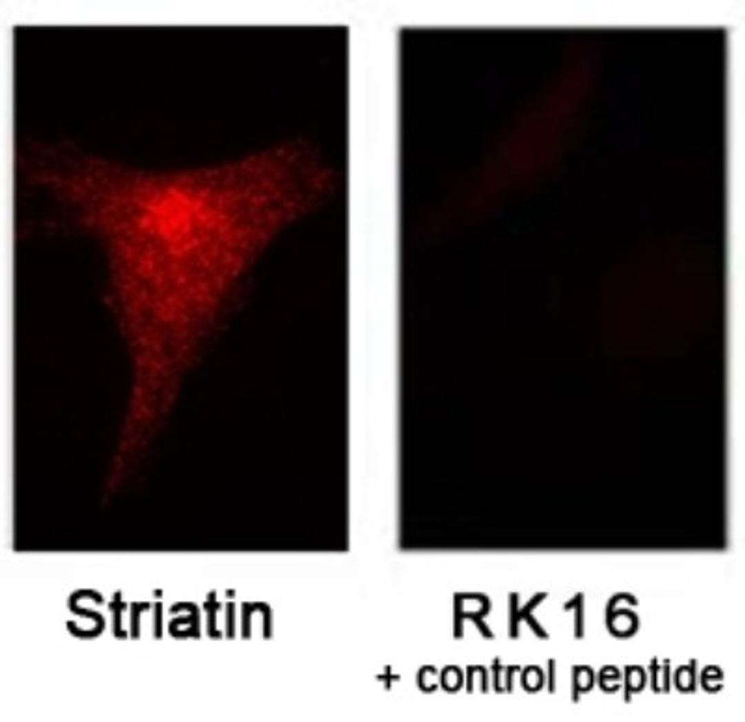 Immunocytochemistry/Immunofluorescence: Striatin Antibody [NB110-74571] - Immunofluorescent staining of NIH3T3 cells ± blocking peptide using NB110-74571.