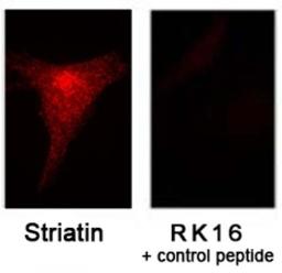 Immunocytochemistry/Immunofluorescence: Striatin Antibody [NB110-74571] - Immunofluorescent staining of NIH3T3 cells ± blocking peptide using NB110-74571.