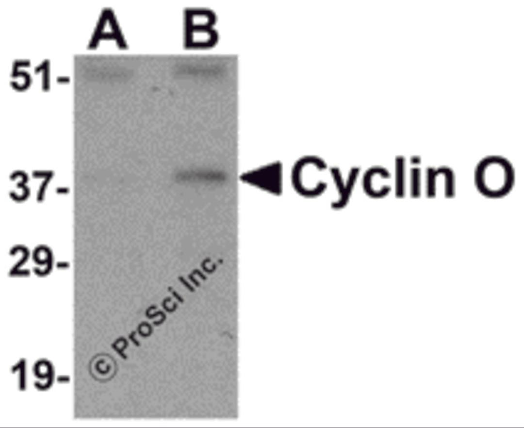 Western blot analysis of Cyclin O in mouse bladder tissue lysate with Cyclin O antibody at (A) 1 and (B) 2 &#956;g/mL.