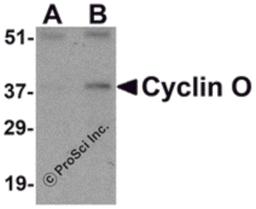 Western blot analysis of Cyclin O in mouse bladder tissue lysate with Cyclin O antibody at (A) 1 and (B) 2 μg/mL.