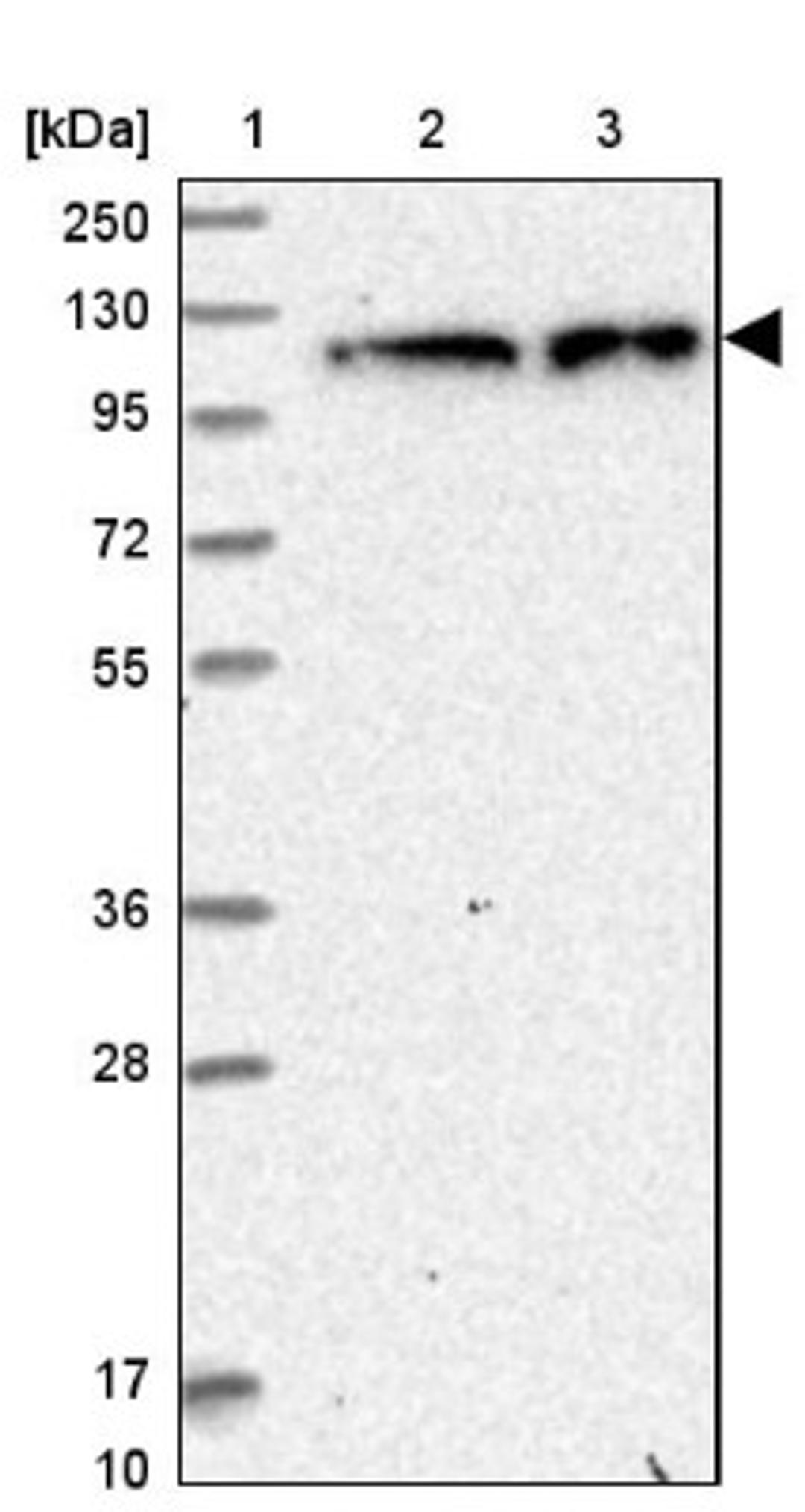 Western Blot: ZC3H7A Antibody [NBP1-82187] - Lane 1: Marker [kDa] 250, 130, 95, 72, 55, 36, 28, 17, 10<br/>Lane 2: Human cell line RT-4<br/>Lane 3: Human cell line U-251MG sp