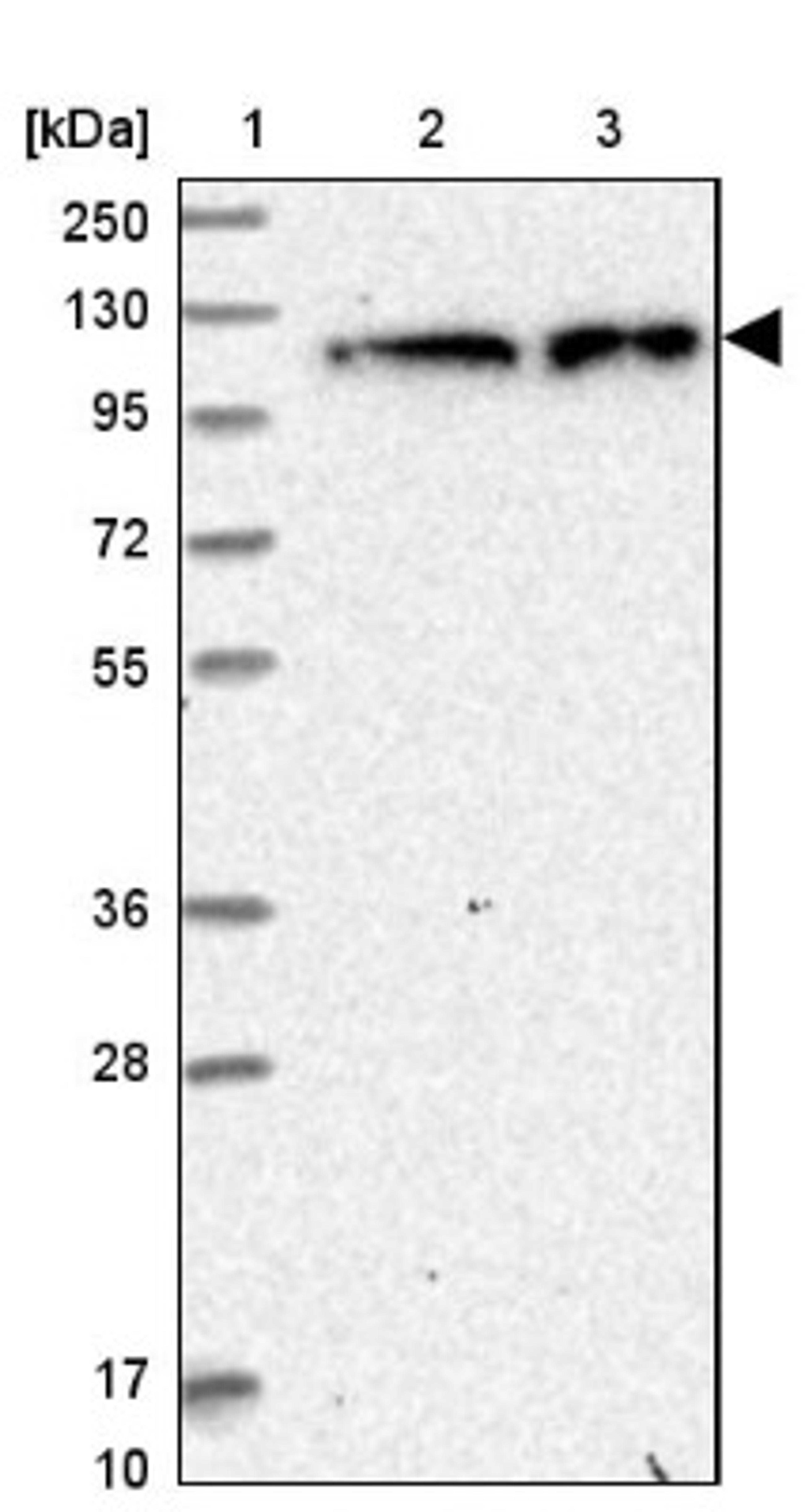 Western Blot: ZC3H7A Antibody [NBP1-82187] - Lane 1: Marker [kDa] 250, 130, 95, 72, 55, 36, 28, 17, 10<br/>Lane 2: Human cell line RT-4<br/>Lane 3: Human cell line U-251MG sp