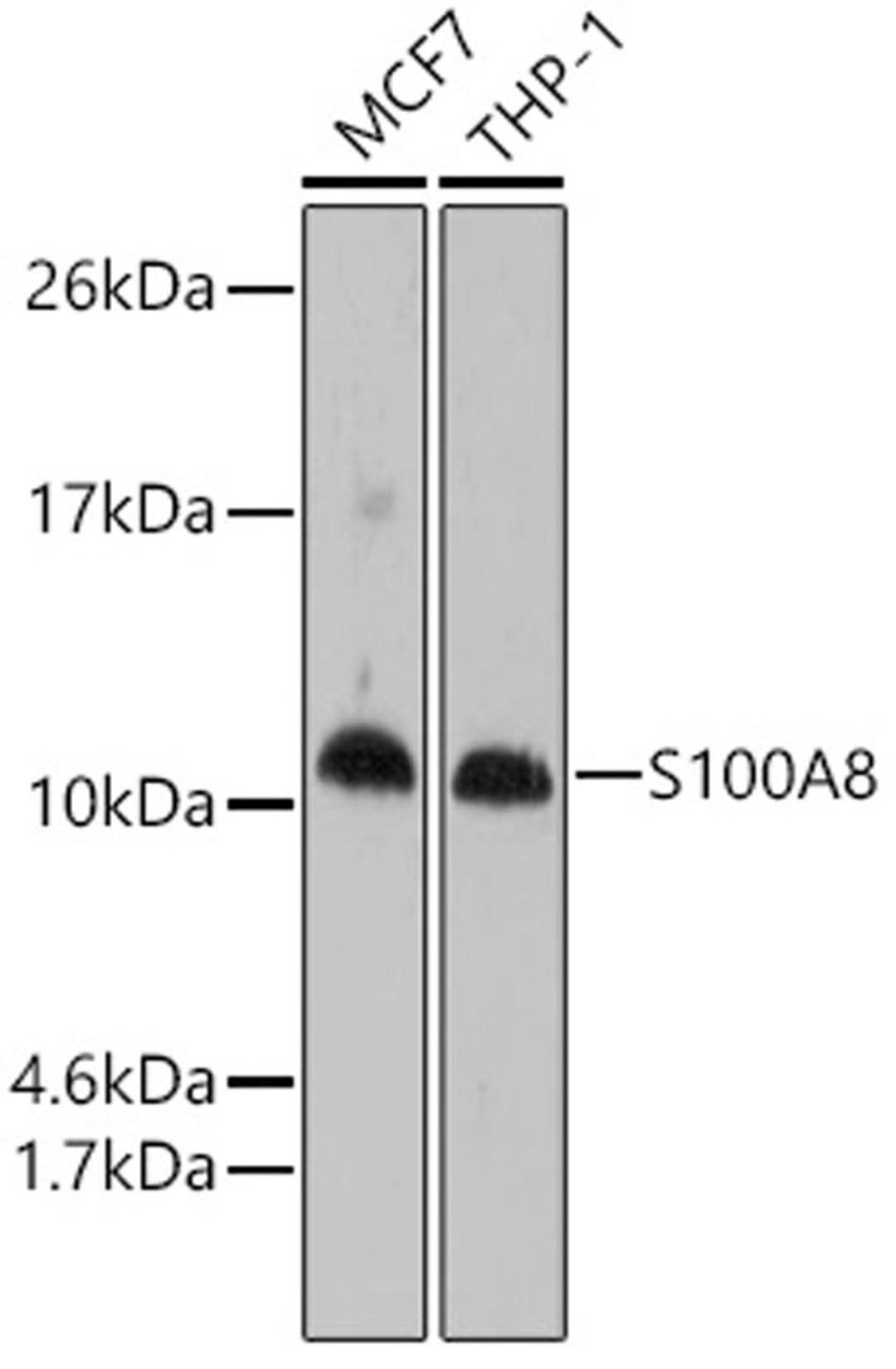 Western blot - S100A8 antibody (A1688)