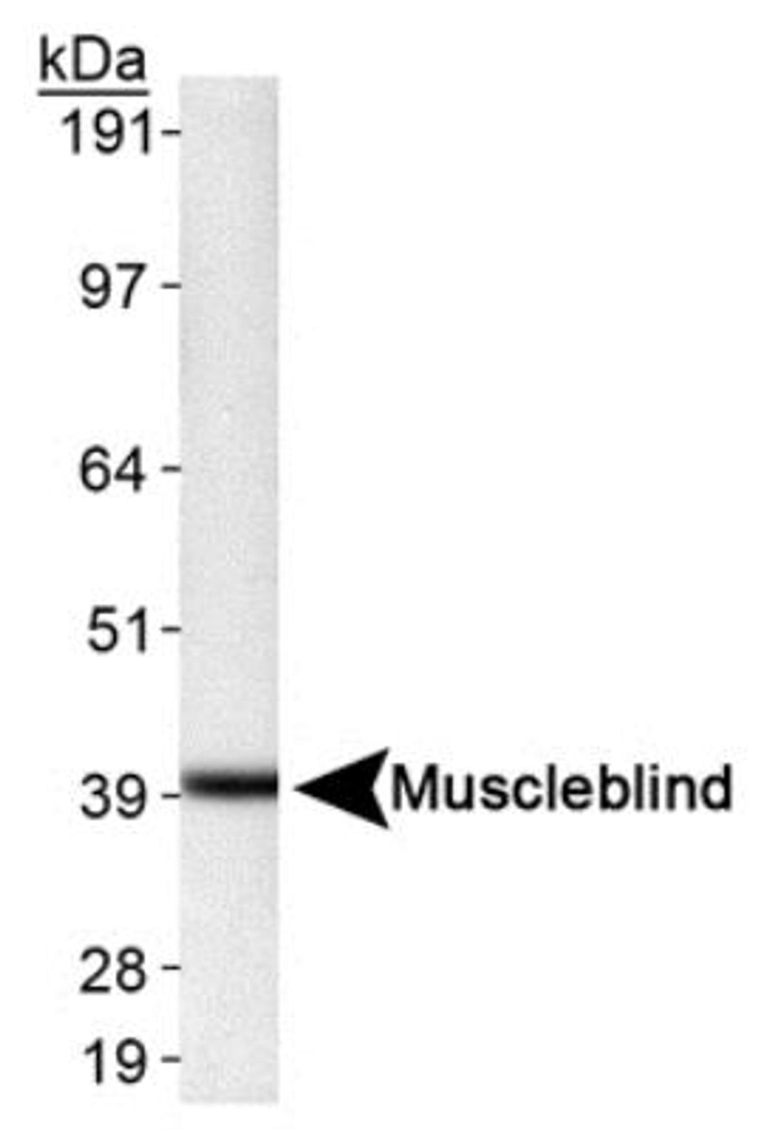 Western Blot: Muscleblind-like 1 Antibody (HL-1822 3A4-1E9) [NB110-37256] - Detection of Muscleblind in HeLa whole cell extract (33ug) using NB 110-37256.