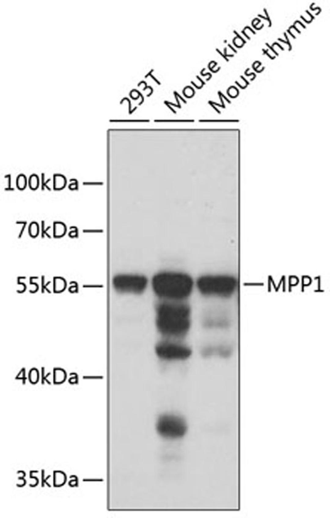 Western blot - MPP1 antibody (A6298)