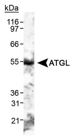 Western Blot: ATGL Antibody [NB110-41536] - Detection of ATGL in human adipose tissue lysate.