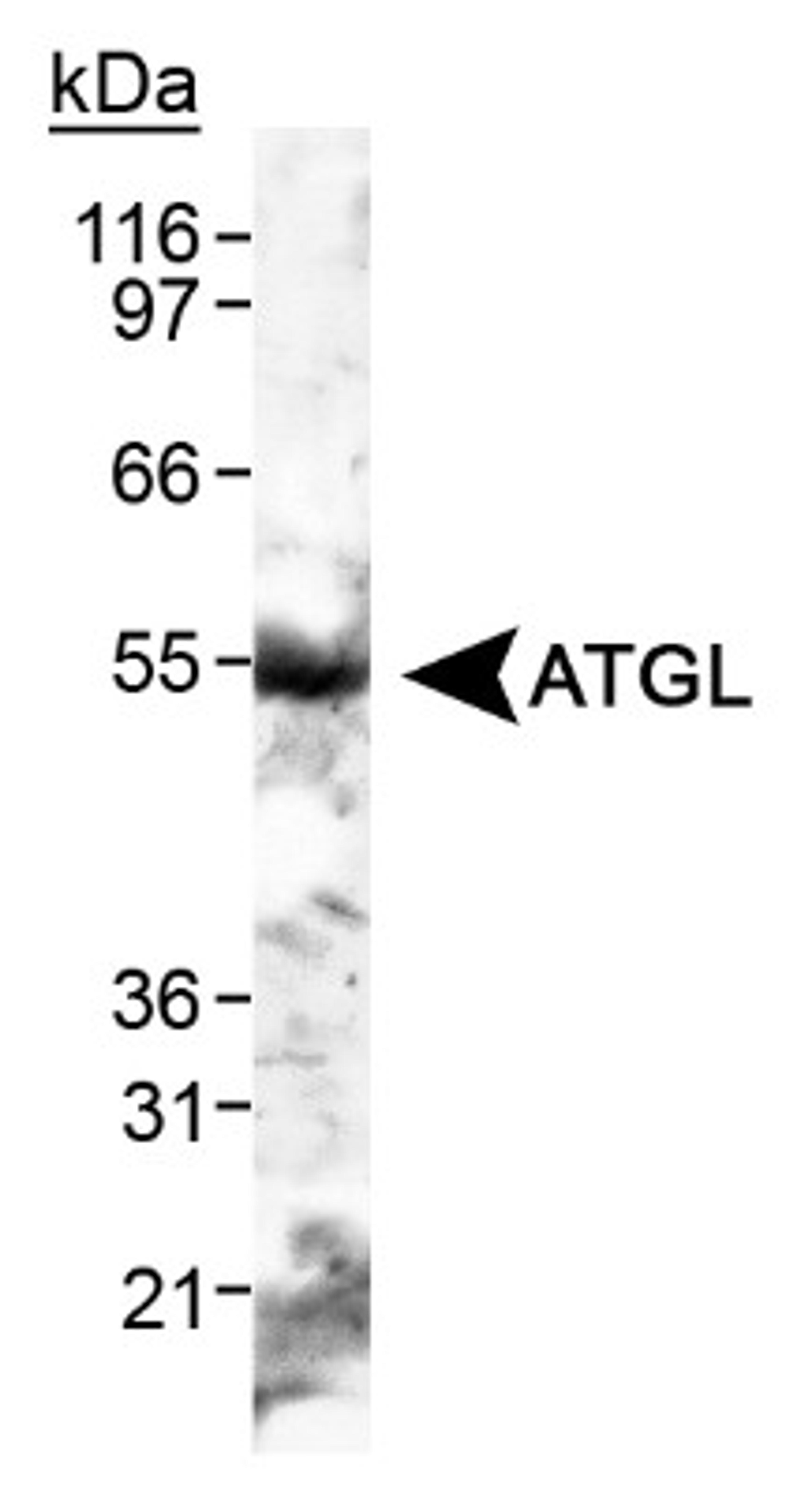 Western Blot: ATGL Antibody [NB110-41536] - Detection of ATGL in human adipose tissue lysate.