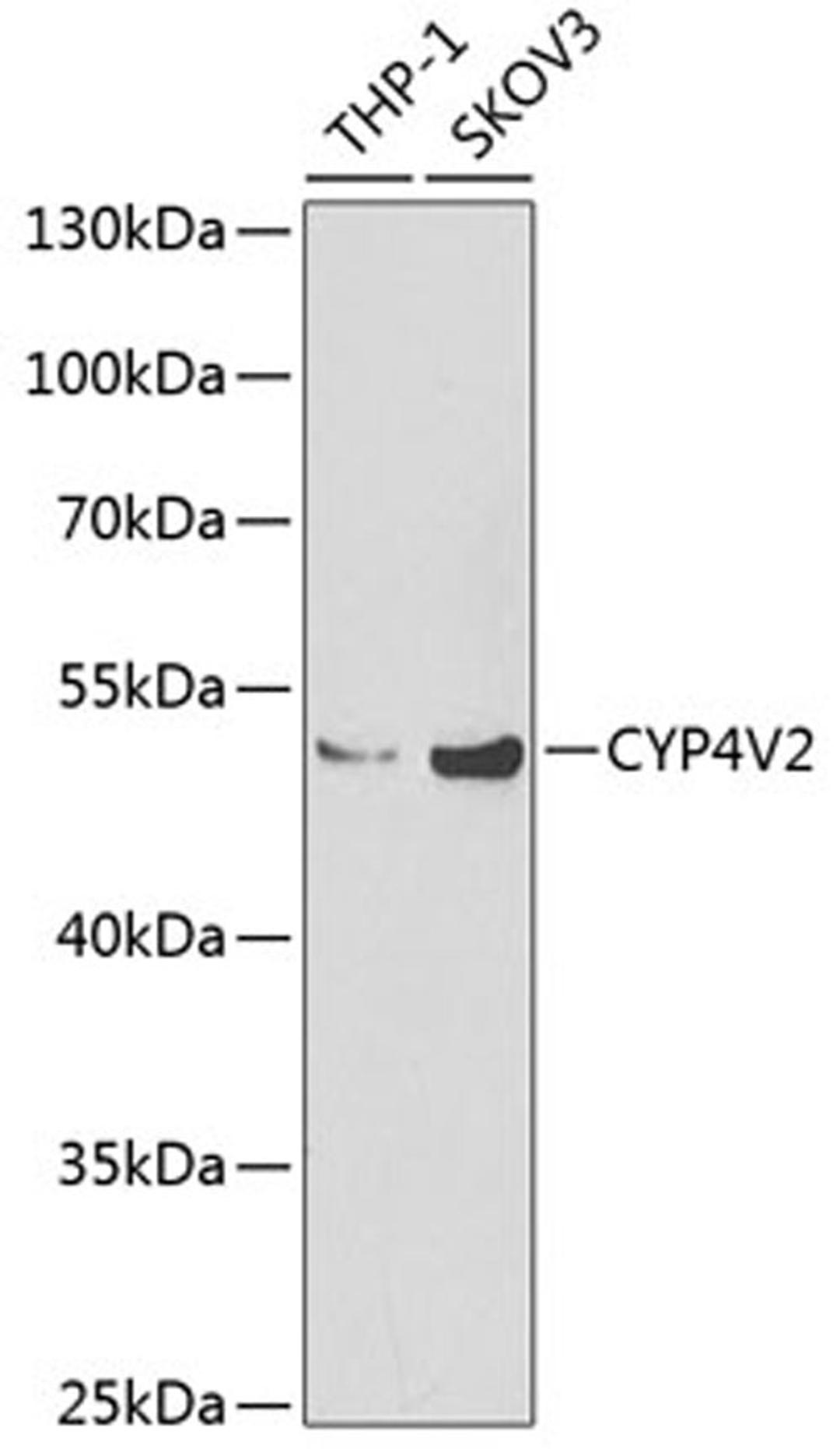 Western blot - CYP4V2 Antibody (A6573)