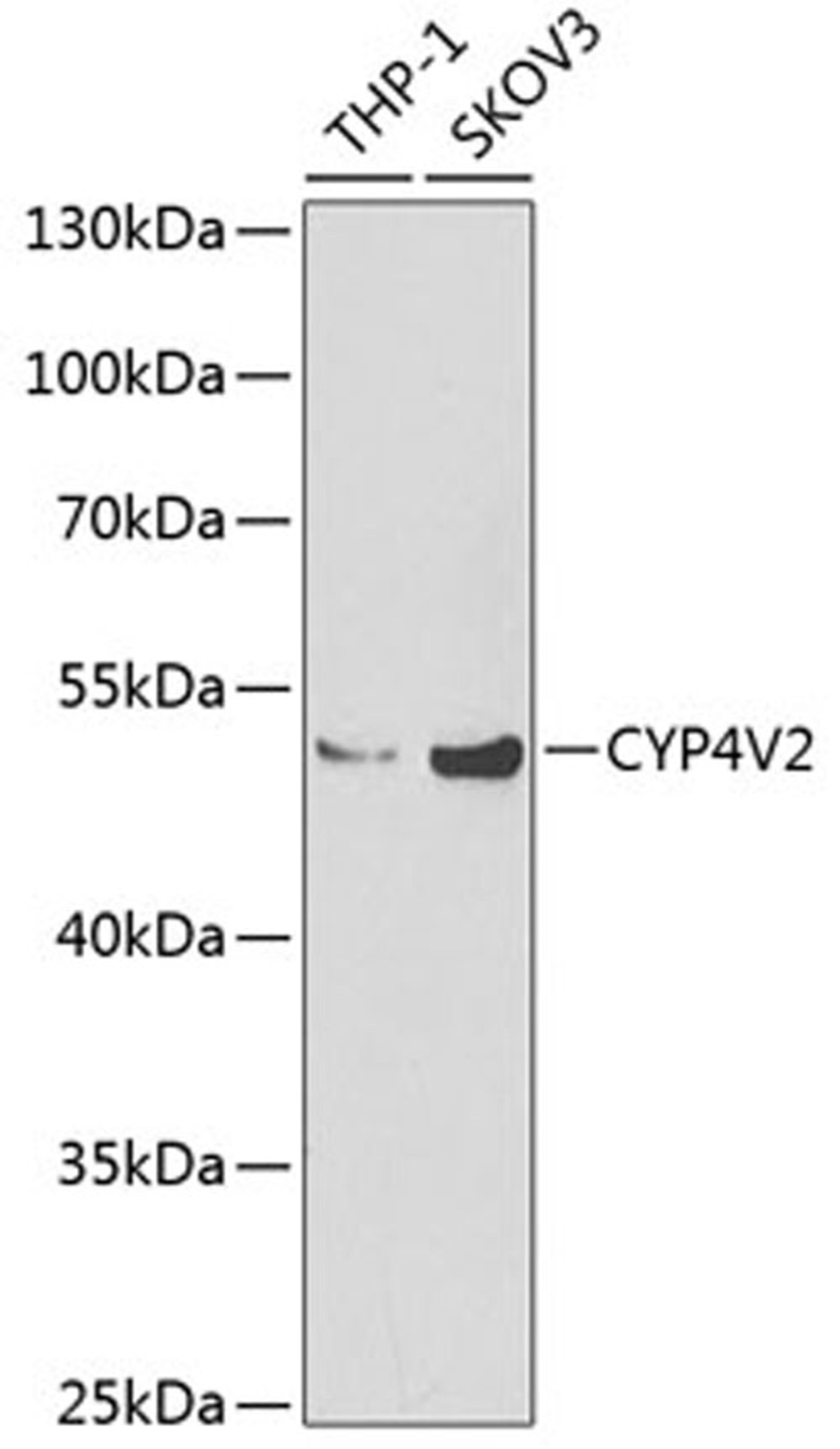 Western blot - CYP4V2 Antibody (A6573)