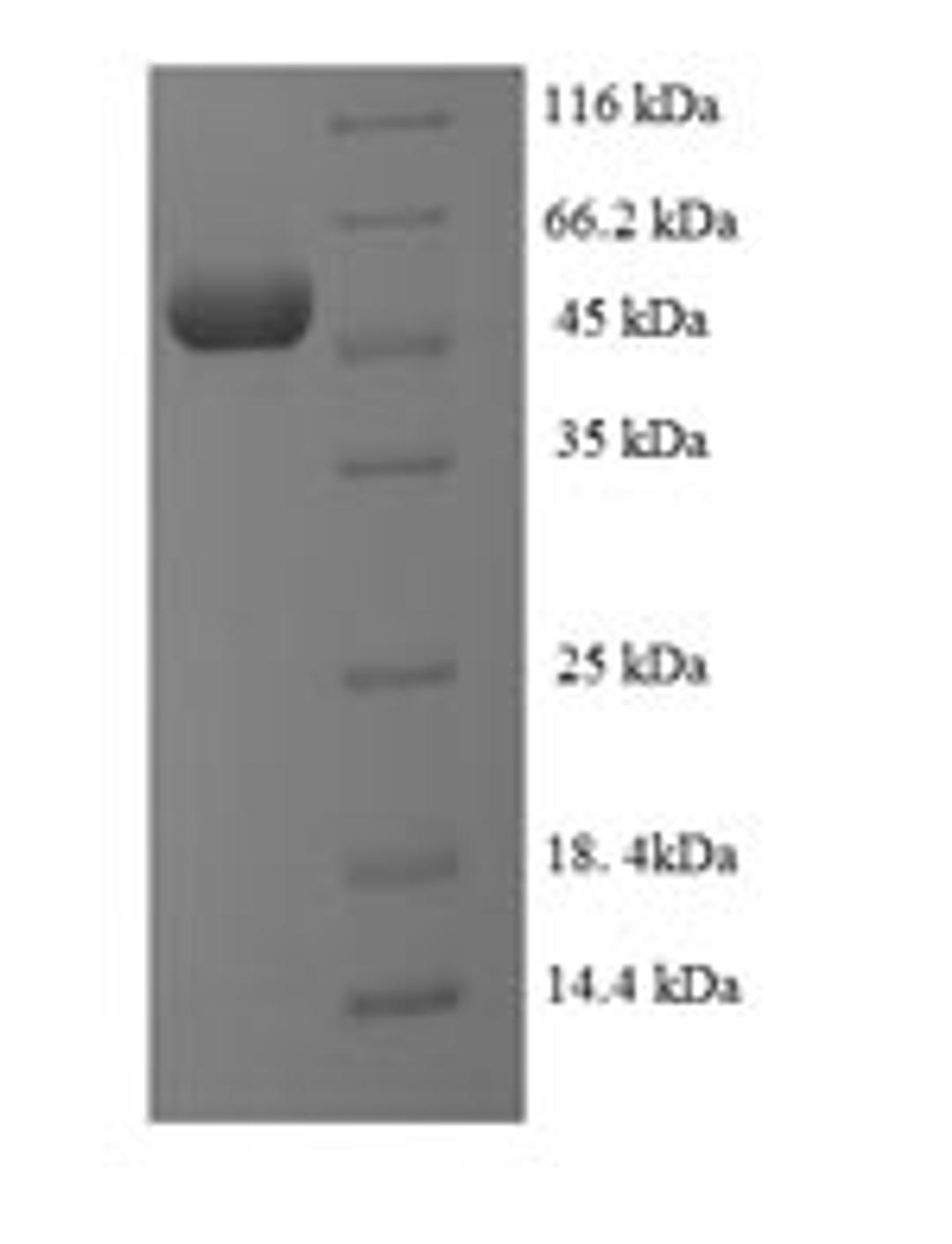 (Tris-Glycine gel) Discontinuous SDS-PAGE (reduced) with 5% enrichment gel and 15% separation gel.