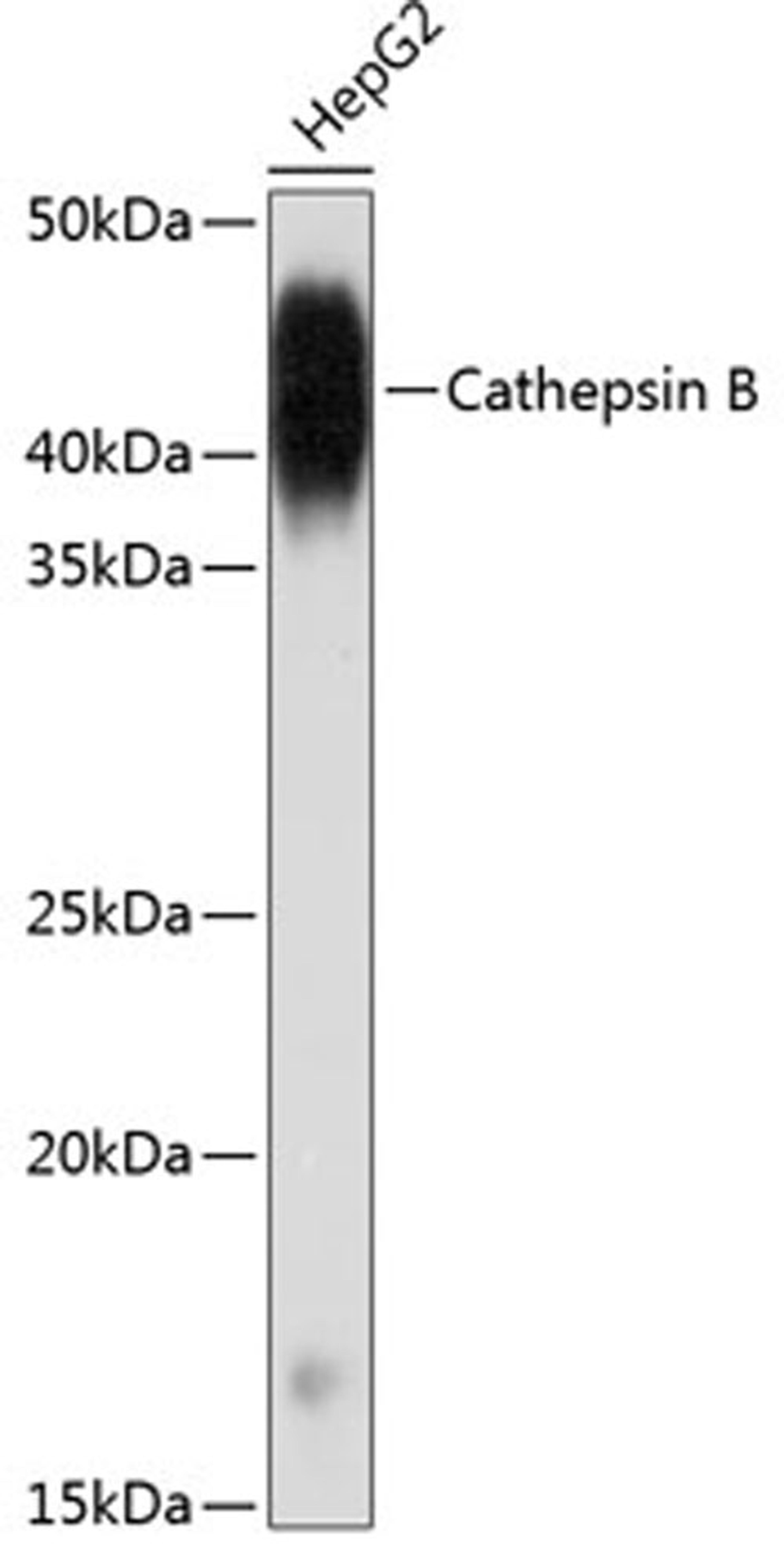 Western blot - Cathepsin B antibody (A19005)