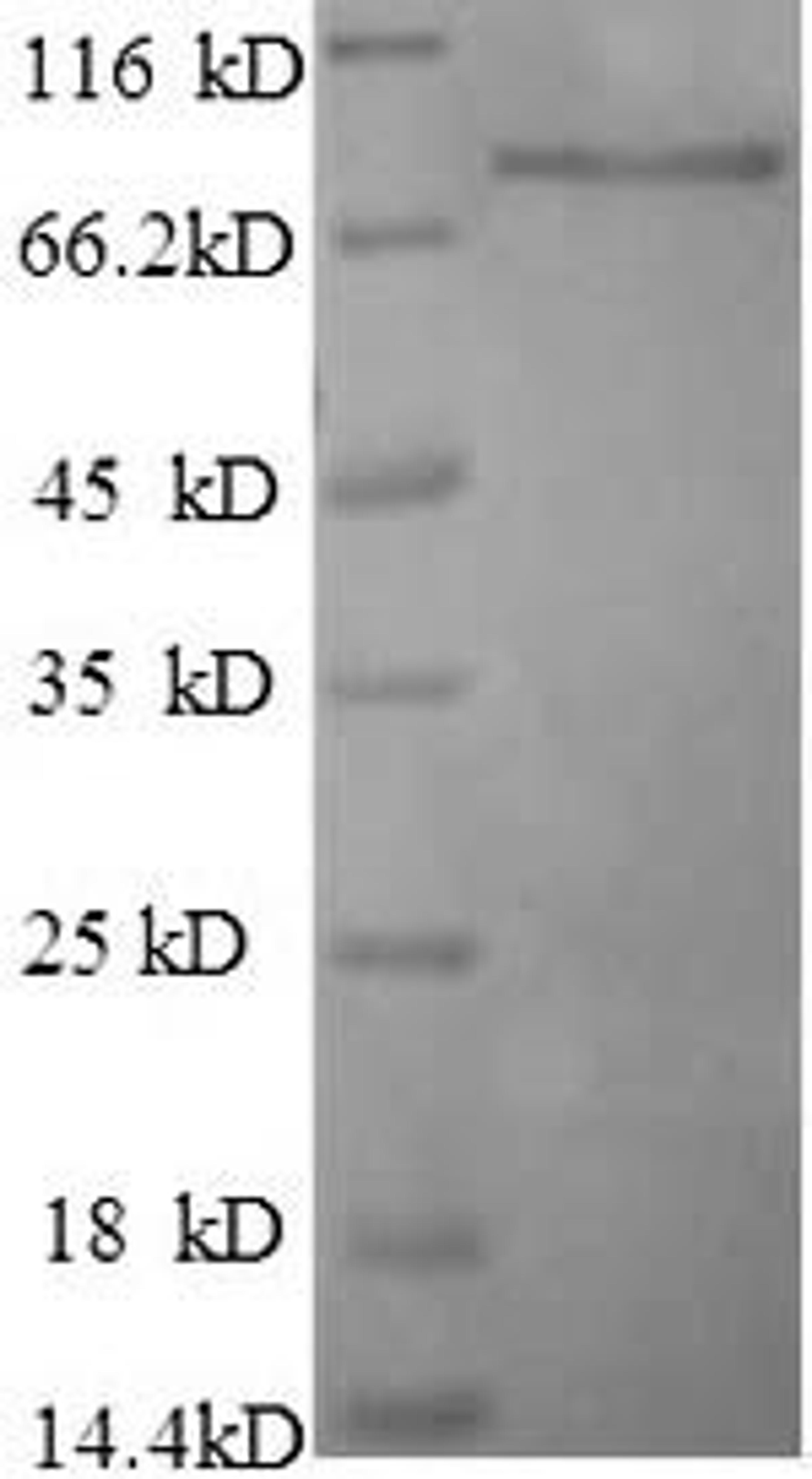 (Tris-Glycine gel) Discontinuous SDS-PAGE (reduced) with 5% enrichment gel and 15% separation gel.