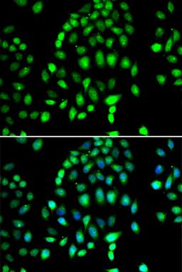 Immunofluorescence - PARP3 antibody (A7297)