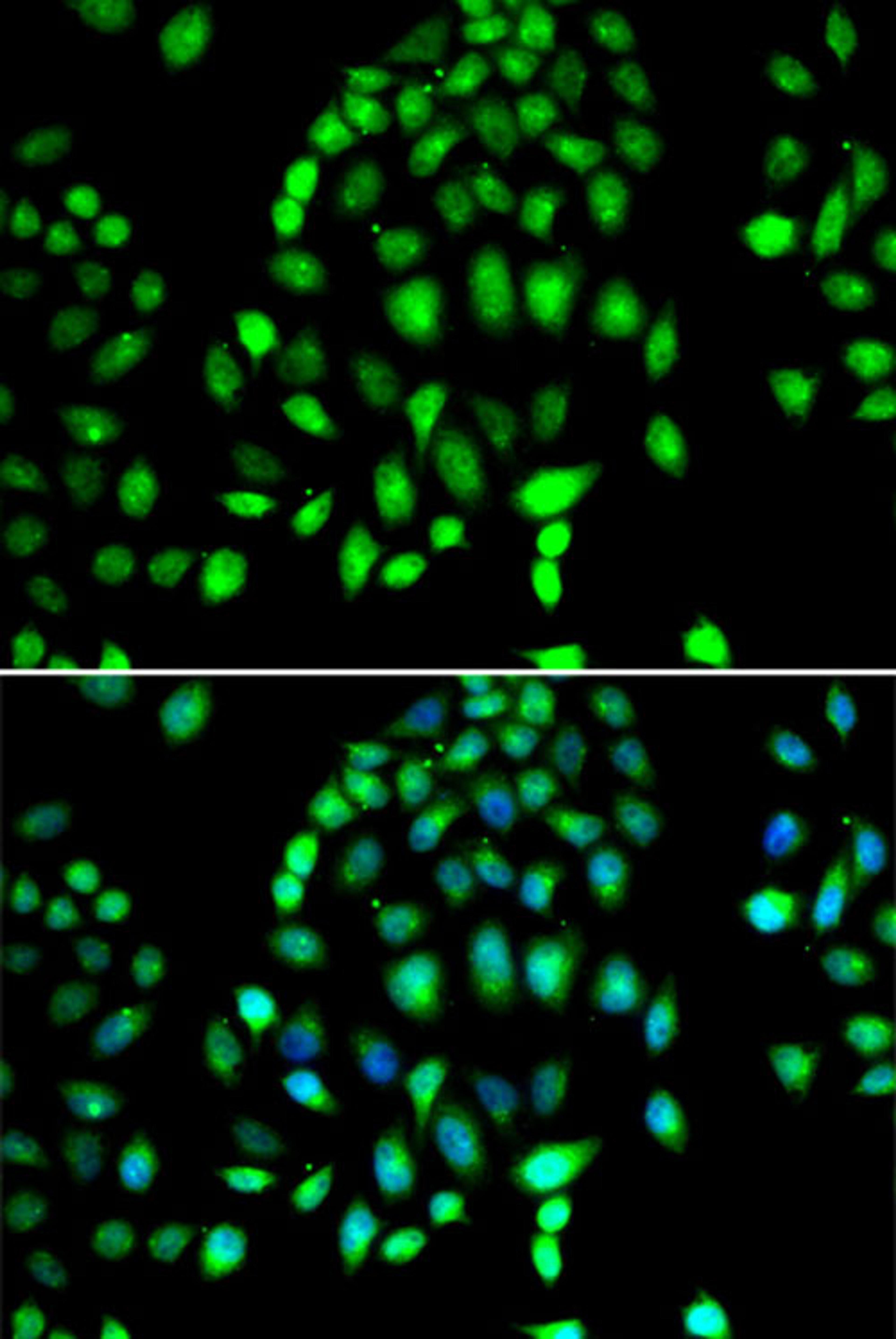 Immunofluorescence - PARP3 antibody (A7297)