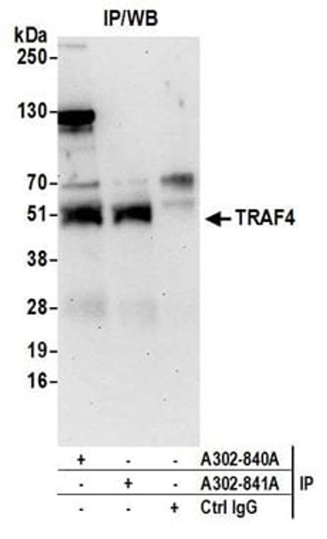 Detection of human TRAF4 by western blot of immunoprecipitates.