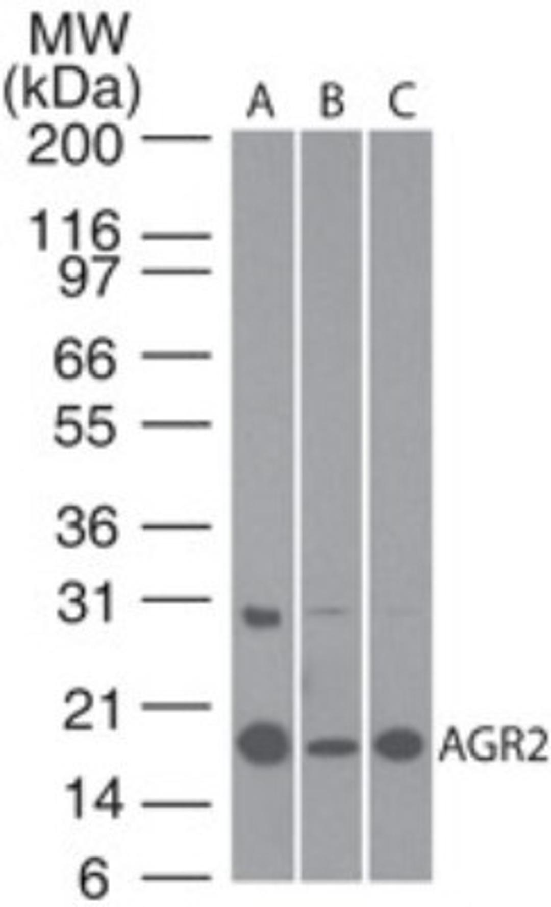 Western Blot: AG-2 Antibody [NBP2-27393] - Analysis using the Azide Free version of NBP2-27393. Detection of AGR2 using AGR2 antibody. MCF7 (A), Caco-2 (B) and human stomach lysate (C) probed with AGR2 antibody at 1:100. were used for this test. The higher molecular weight band of variable intensity at ~30 kDa is uncharacterized and may represent a form of AGR2.