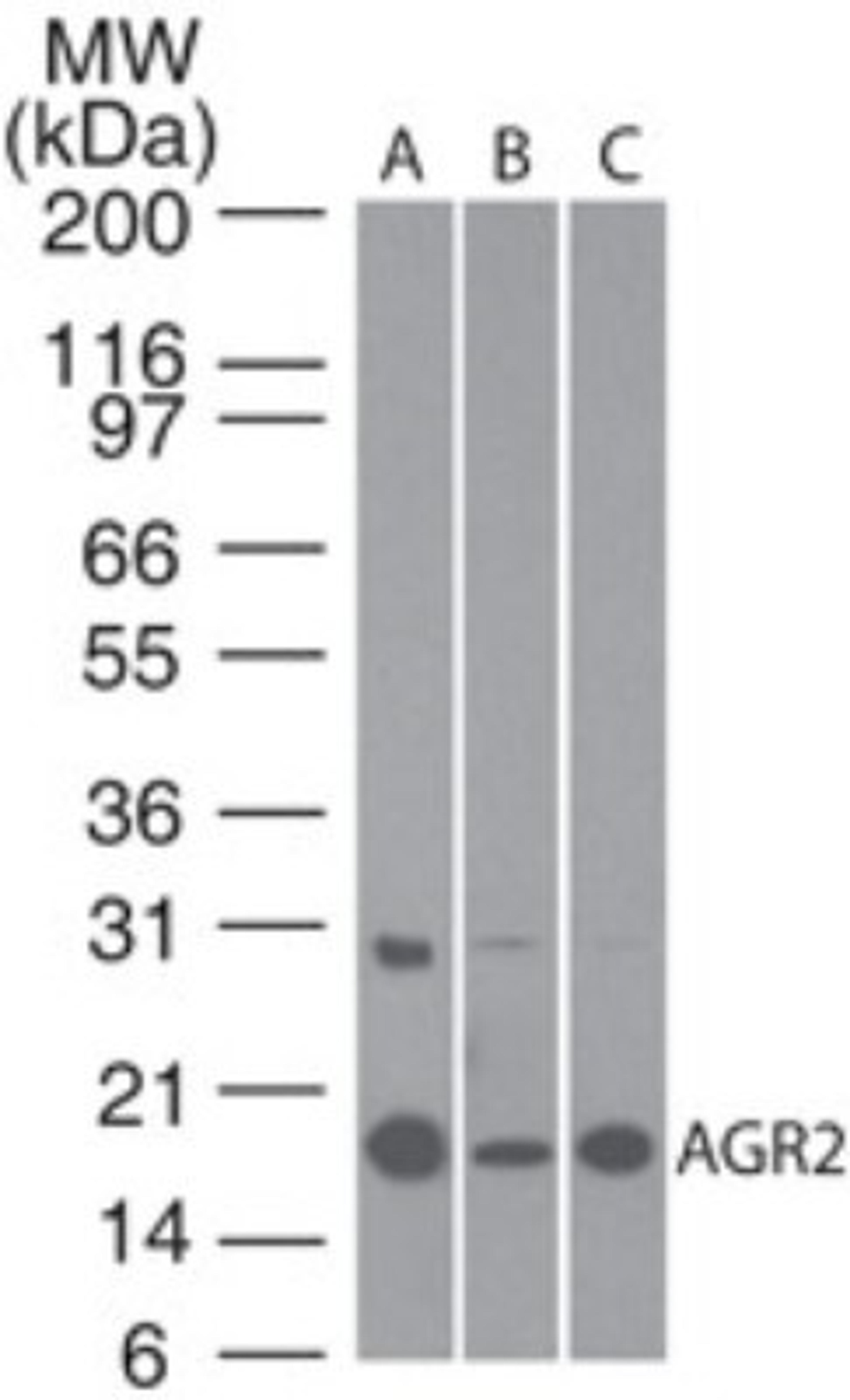 Western Blot: AG-2 Antibody [NBP2-27393] - Analysis using the Azide Free version of NBP2-27393. Detection of AGR2 using AGR2 antibody. MCF7 (A), Caco-2 (B) and human stomach lysate (C) probed with AGR2 antibody at 1:100. were used for this test. The higher molecular weight band of variable intensity at ~30 kDa is uncharacterized and may represent a form of AGR2.