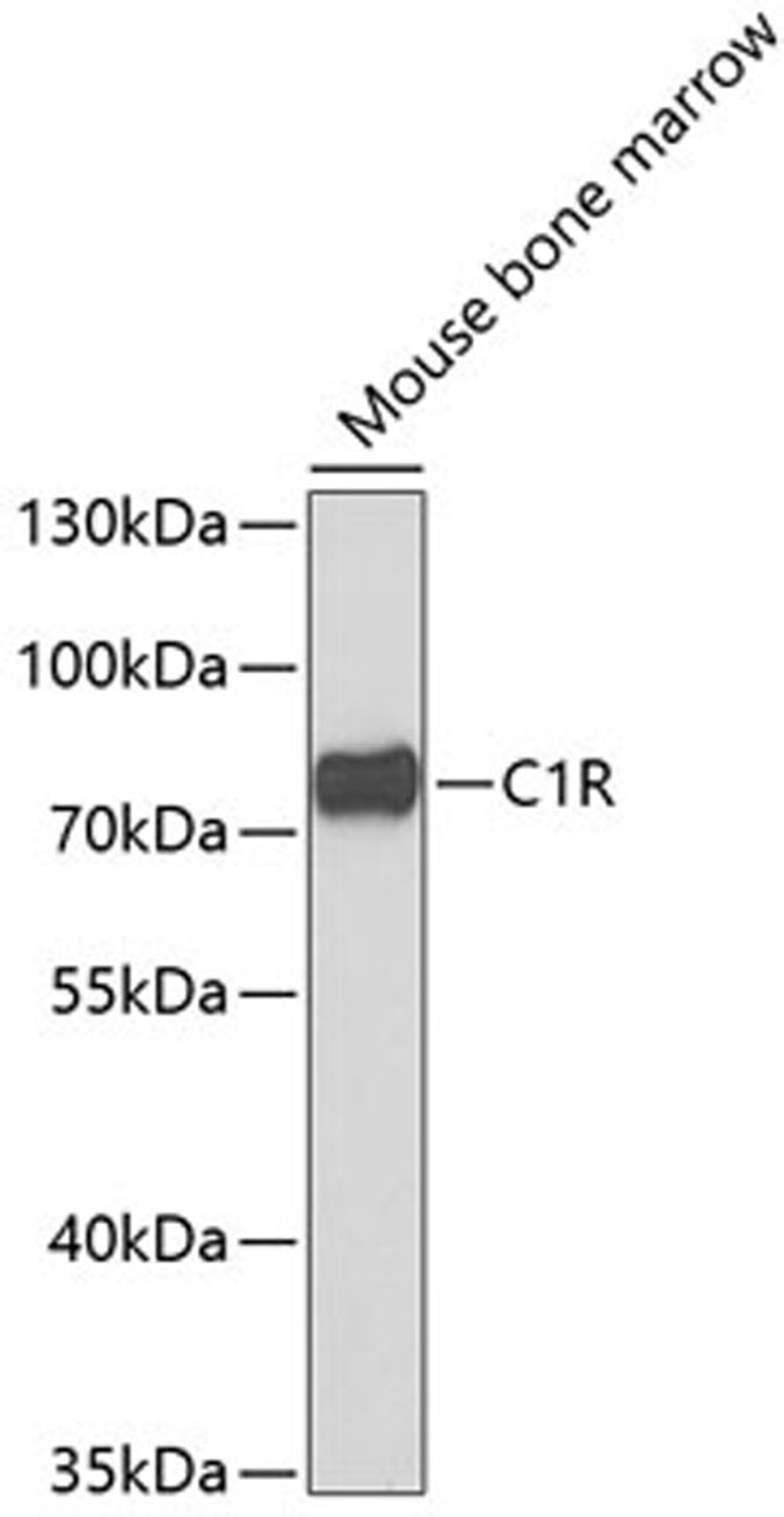 Western blot - C1R antibody (A6360)