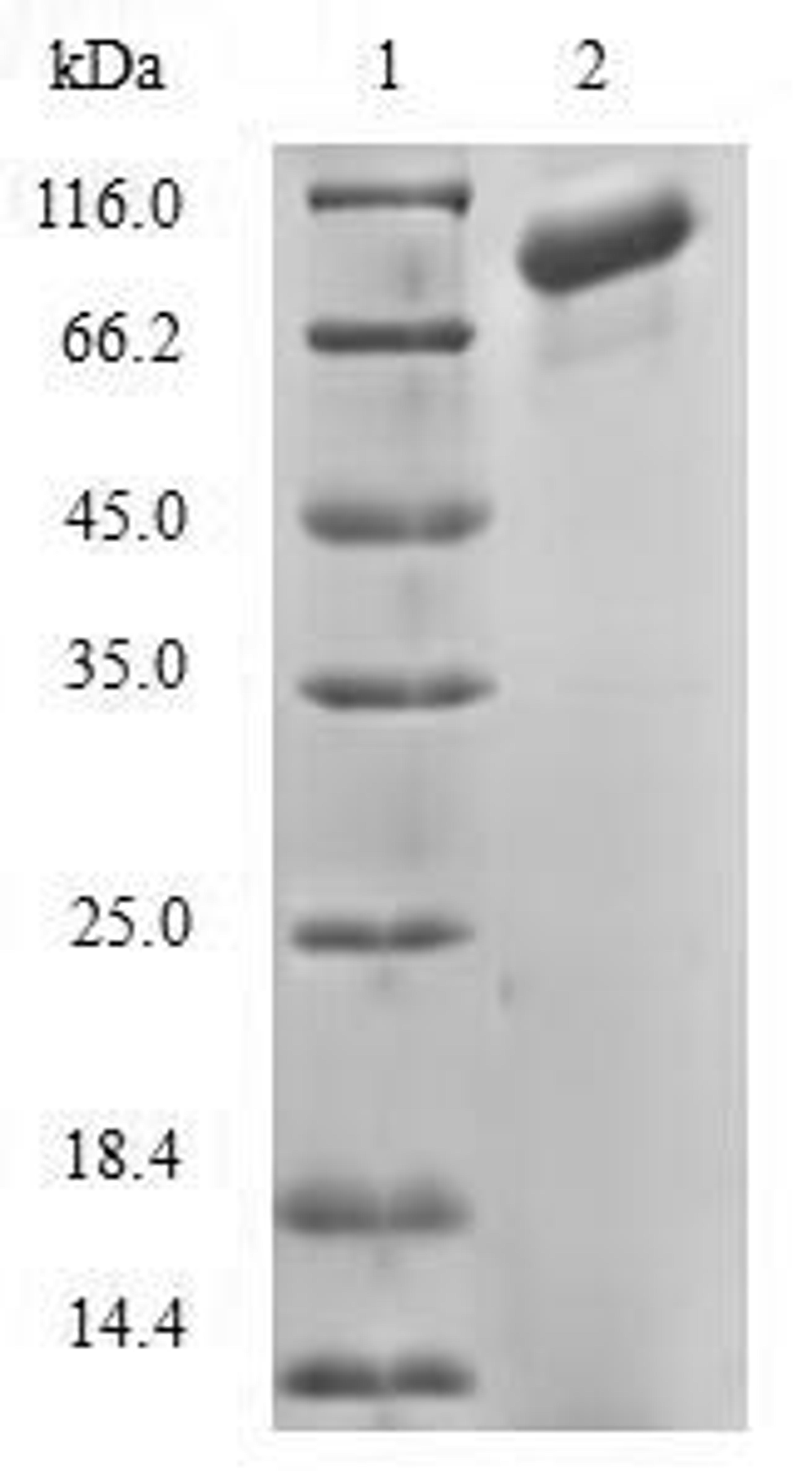 (Tris-Glycine gel) Discontinuous SDS-PAGE (reduced) with 5% enrichment gel and 15% separation gel.