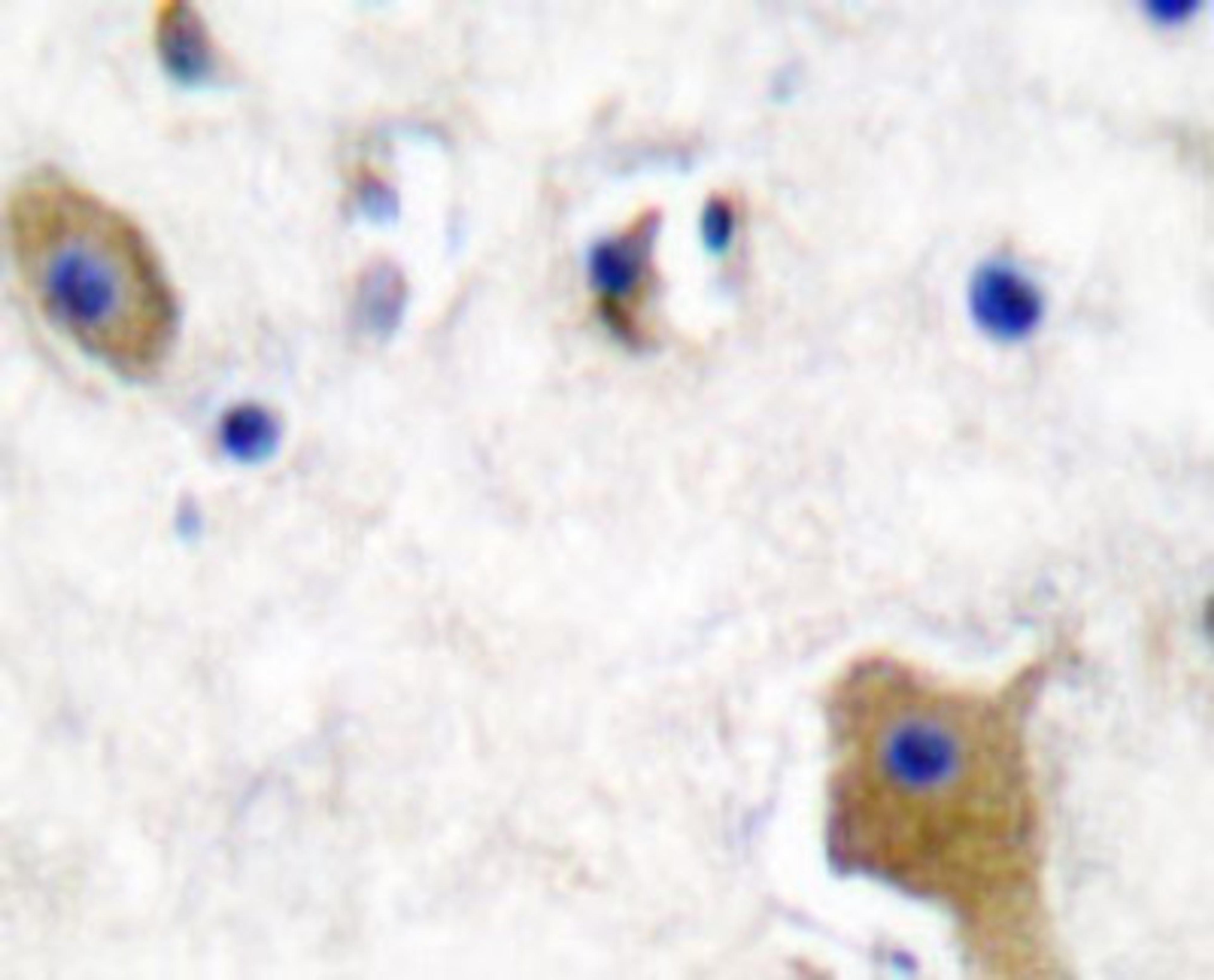 Immunohistochemistry-Paraffin: Tau [p Ser356] Antibody [NBP1-19906] - Paraffin-embedded human brain tissue.