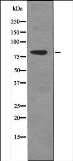 Western blot analysis of EGF treated 293 whole cell lysates using eEF2K -Phospho-Ser359- antibody