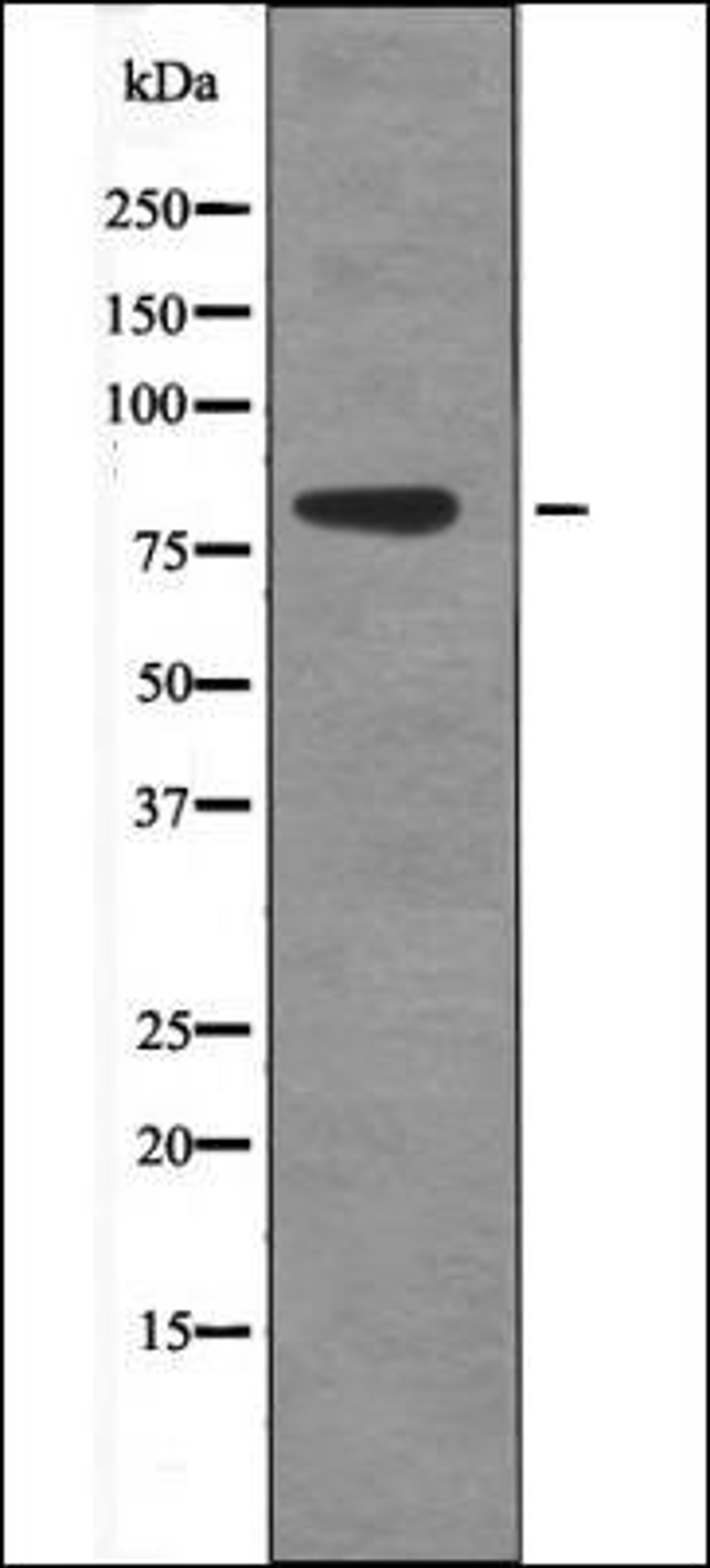 Western blot analysis of EGF treated 293 whole cell lysates using eEF2K -Phospho-Ser359- antibody