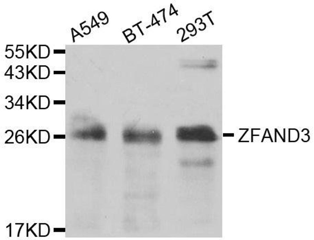 Western blot analysis of extracts of various cell lines using ZFAND3 antibody