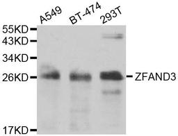 Western blot analysis of extracts of various cell lines using ZFAND3 antibody