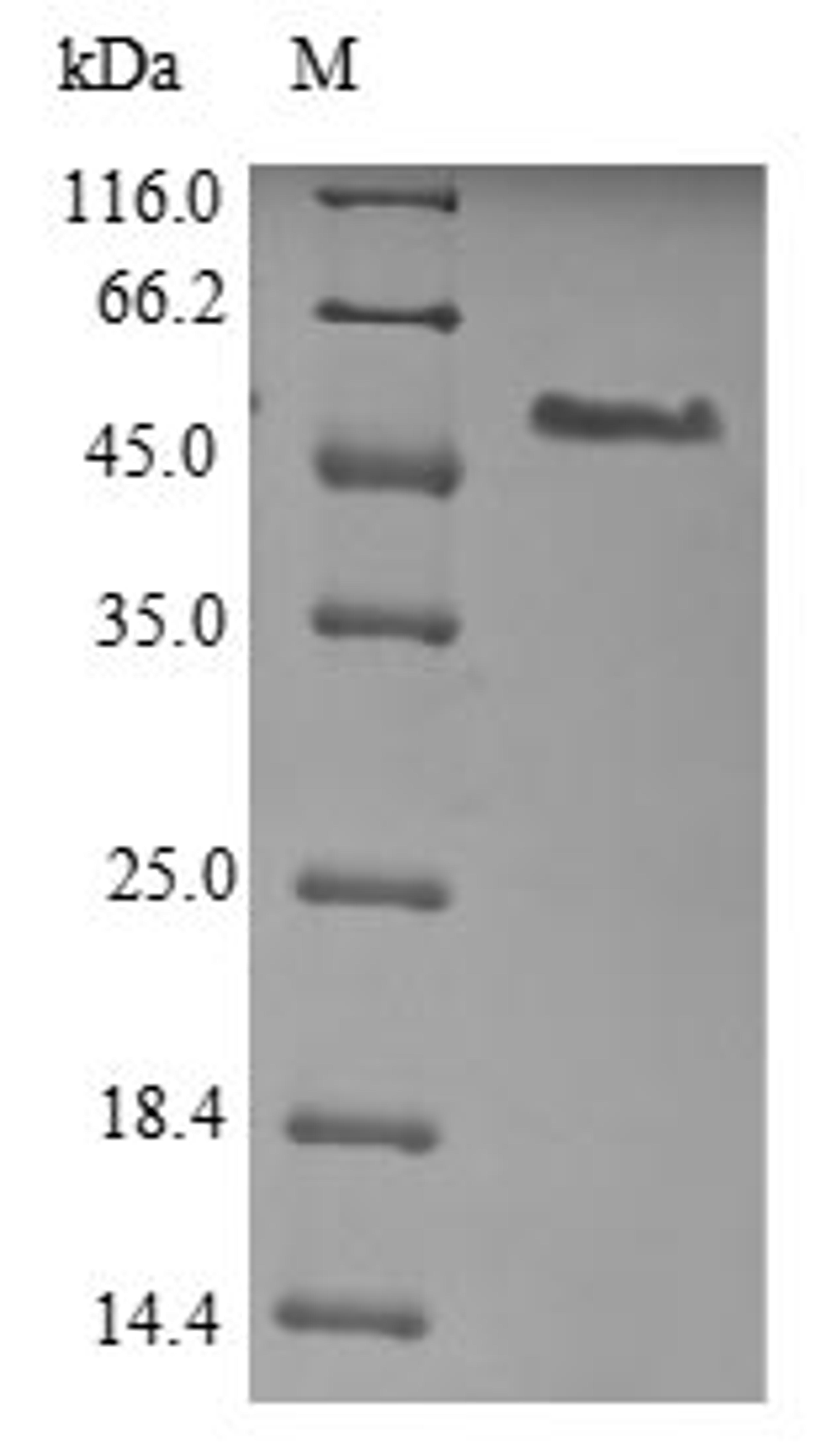 (Tris-Glycine gel) Discontinuous SDS-PAGE (reduced) with 5% enrichment gel and 15% separation gel.